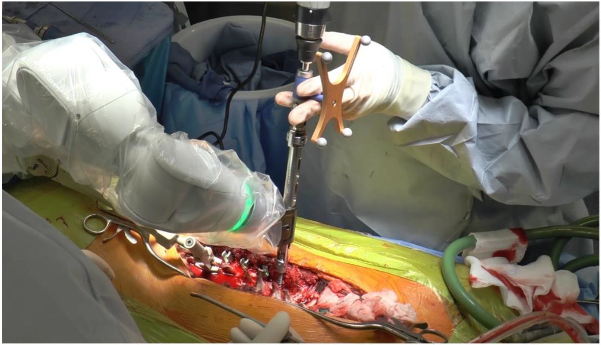 Sensors 22 05204 g002 550