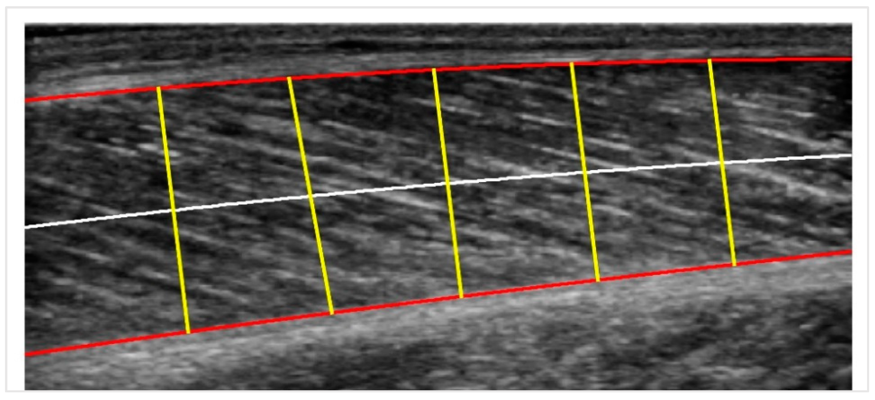 Sensors 22 05230 g004