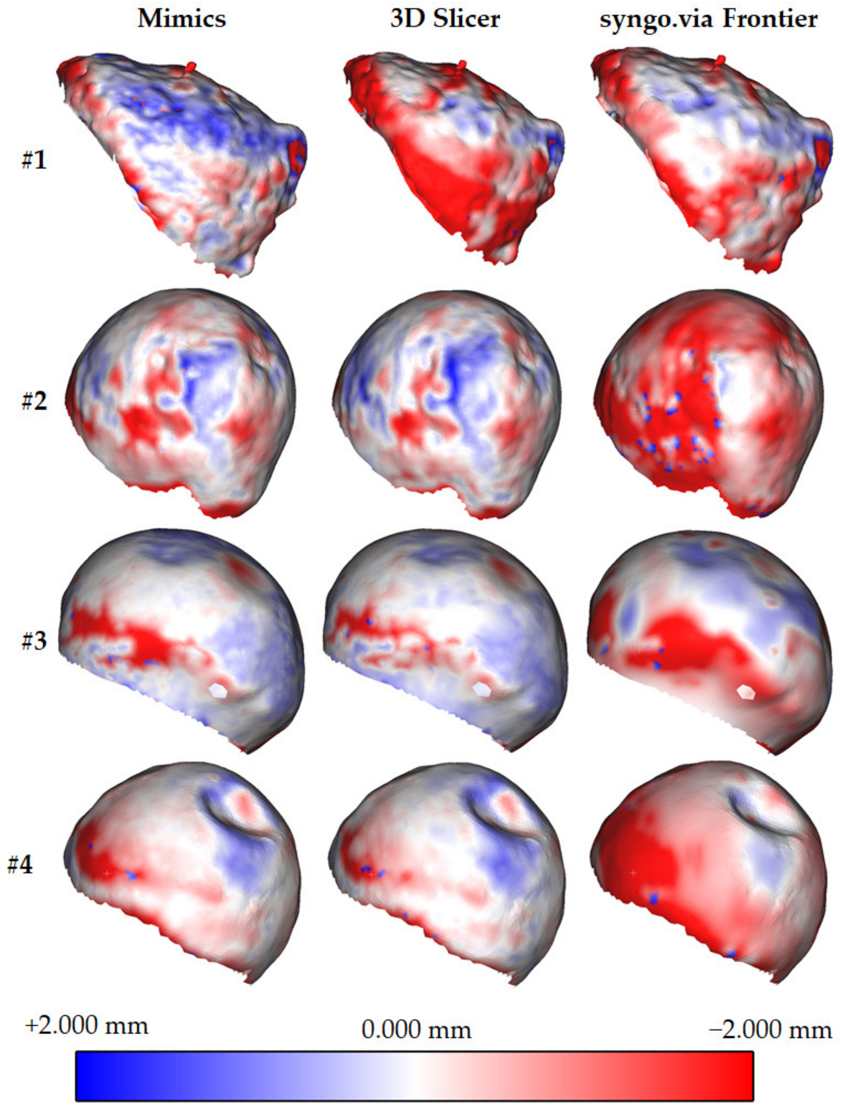 Sensors 22 05242 g004