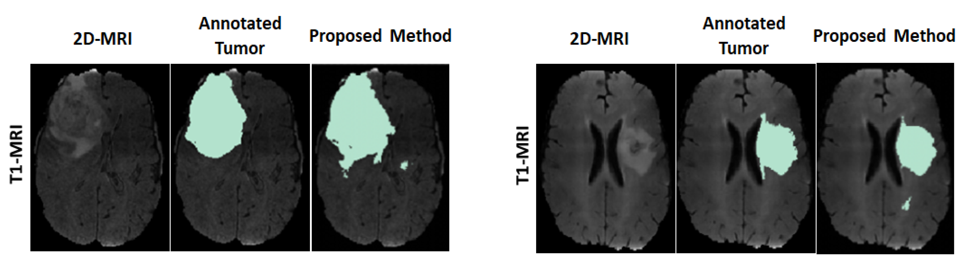 Sensors 22 05292 g004 550
