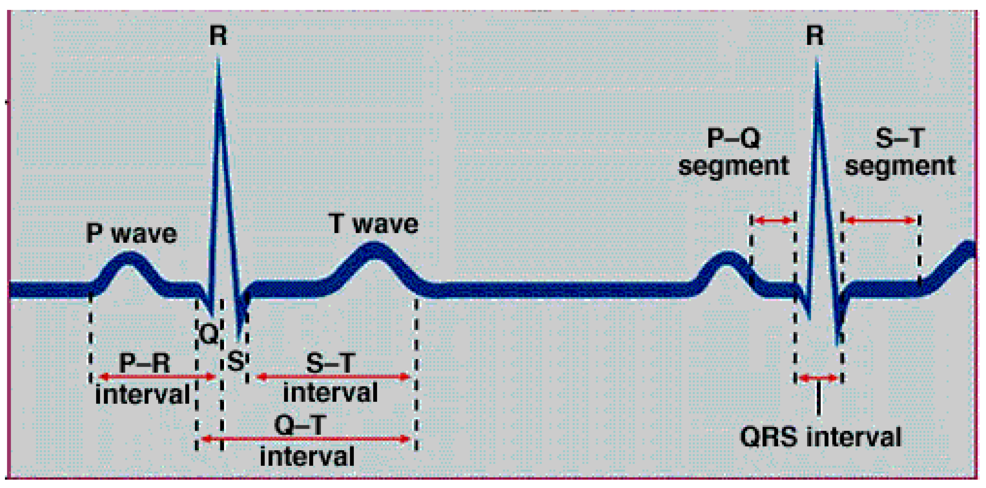 Sensors 22 05327 g003 550