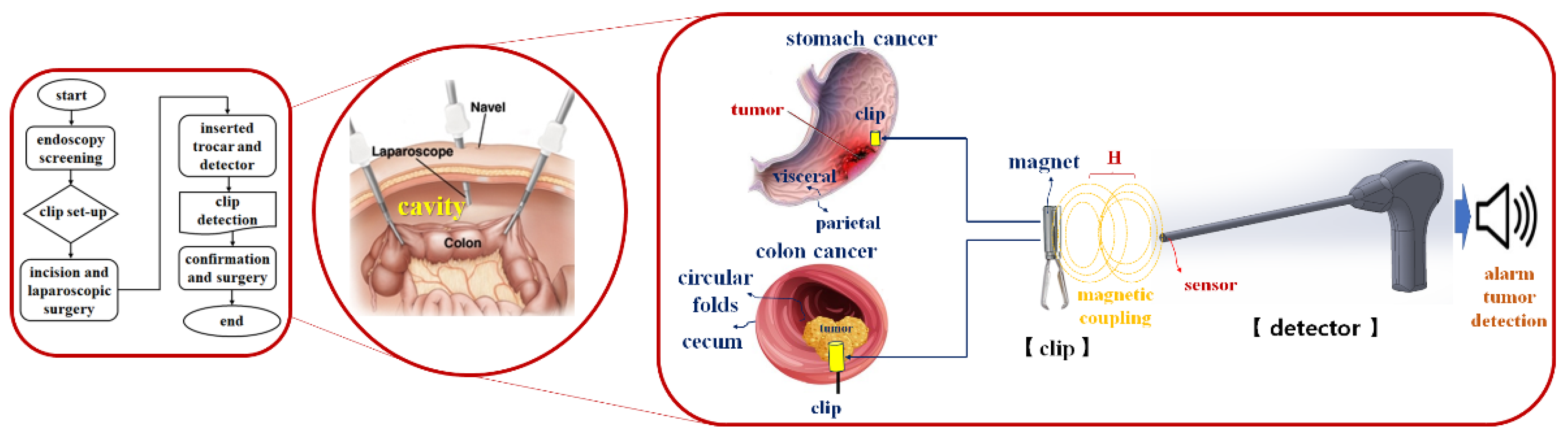 Sensors 22 05404 g001