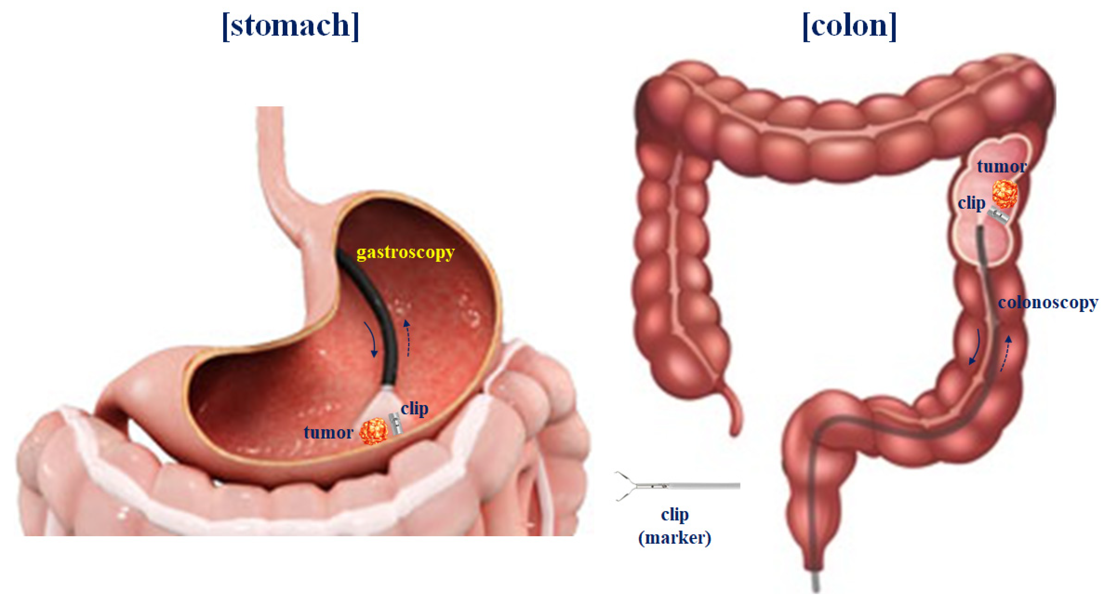 Sensors 22 05404 g011