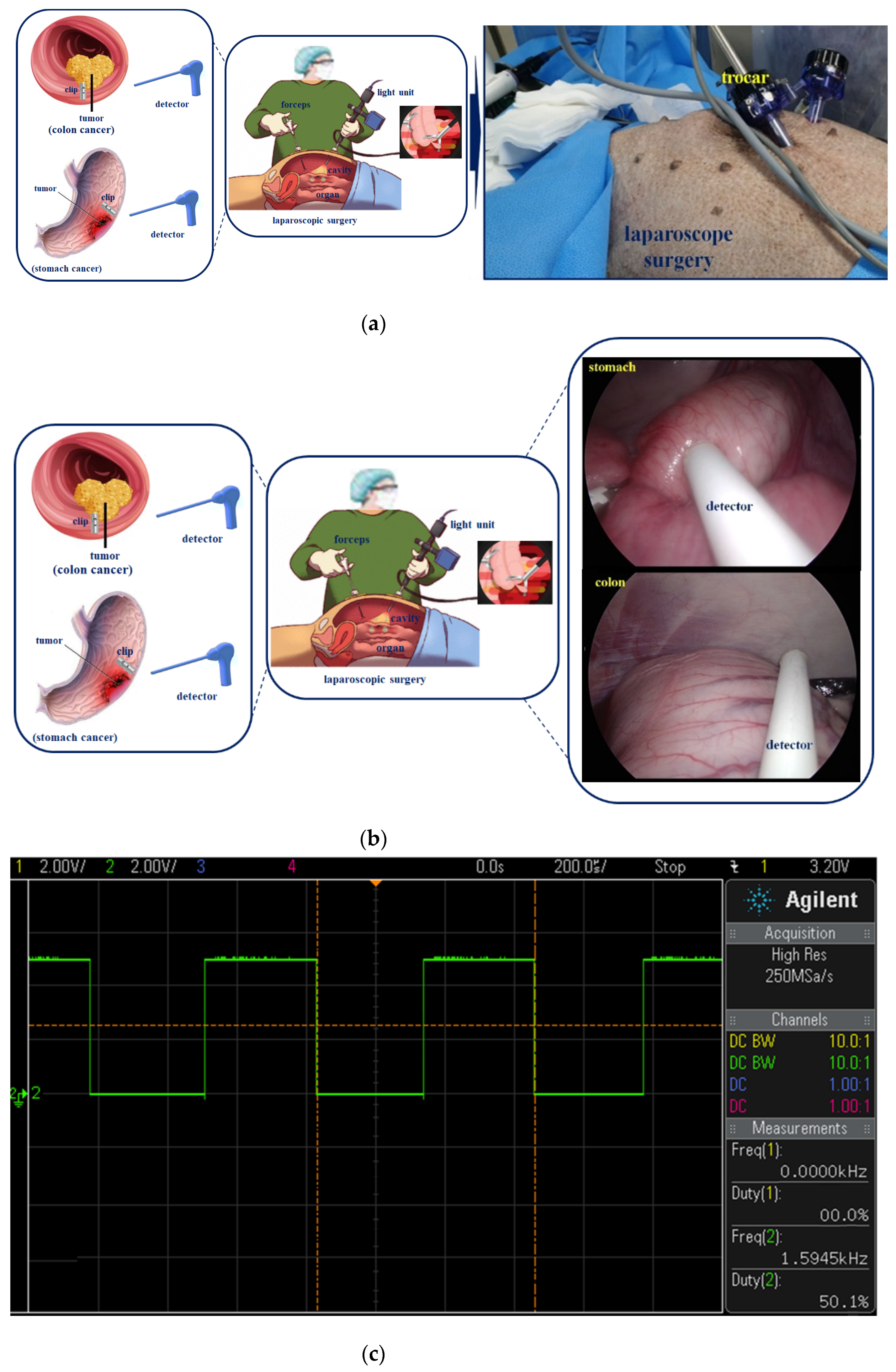 Sensors 22 05404 g013