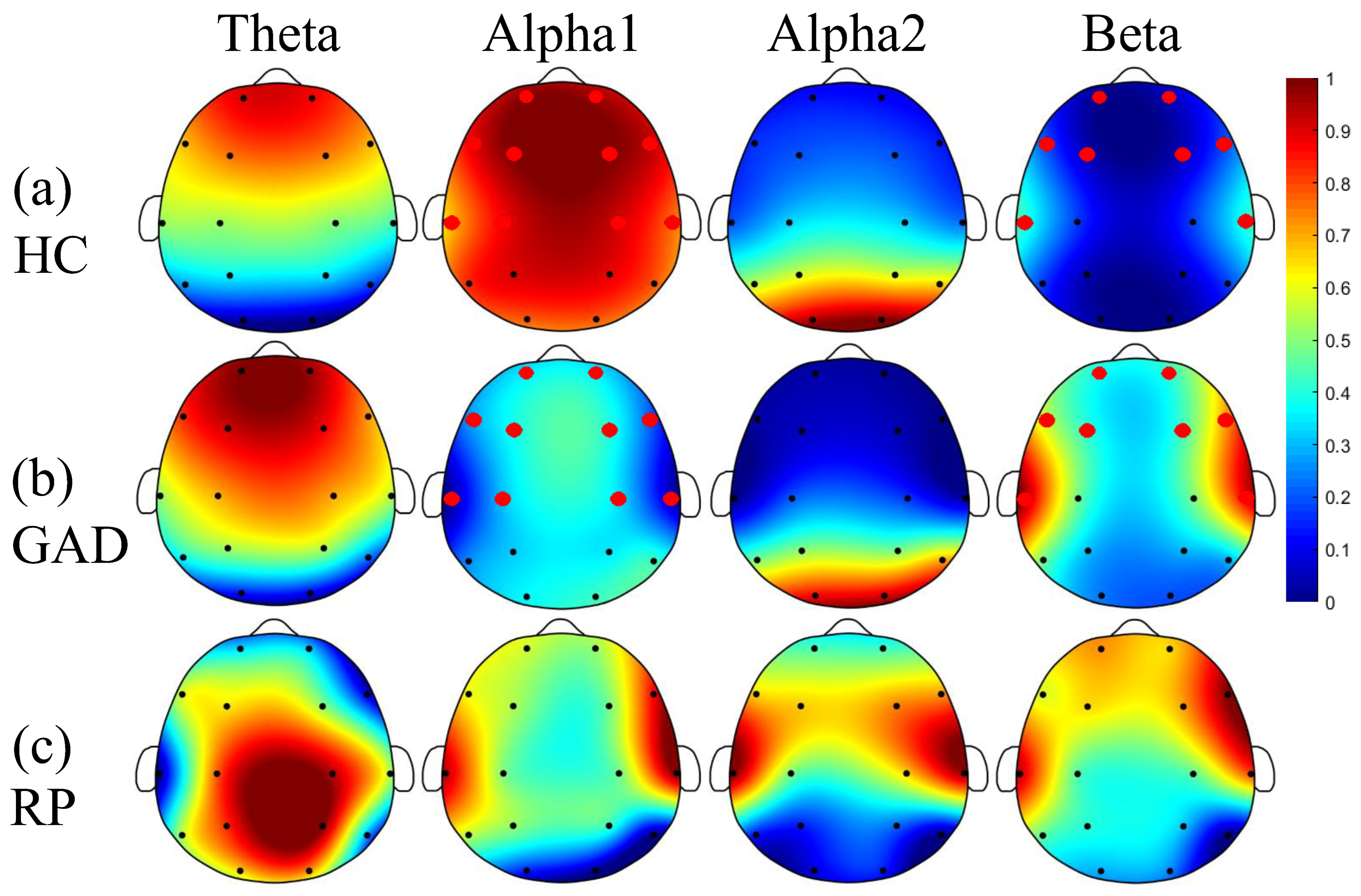 Study finds EEG brain tests can help patients overcome depression