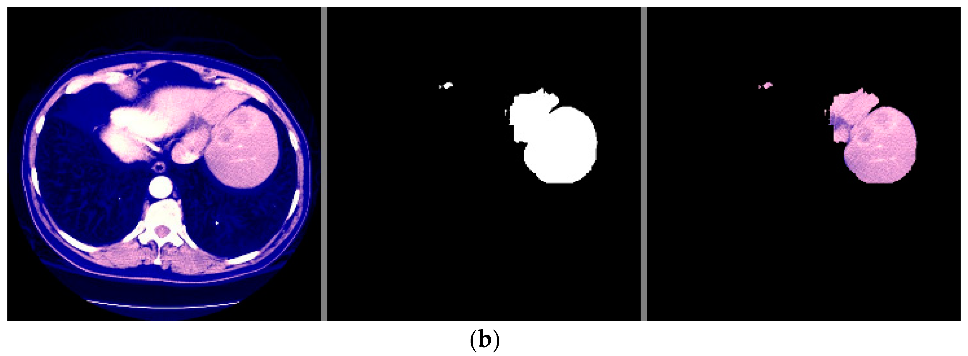Sensors 22 05429 g012b