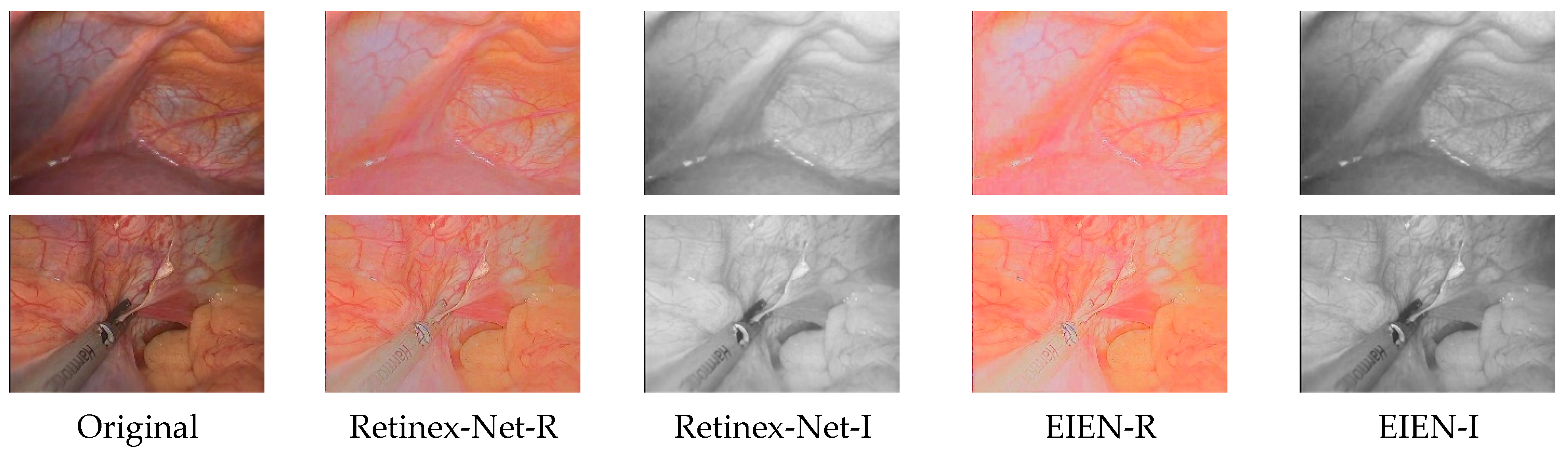 Sensors 22 05464 g011