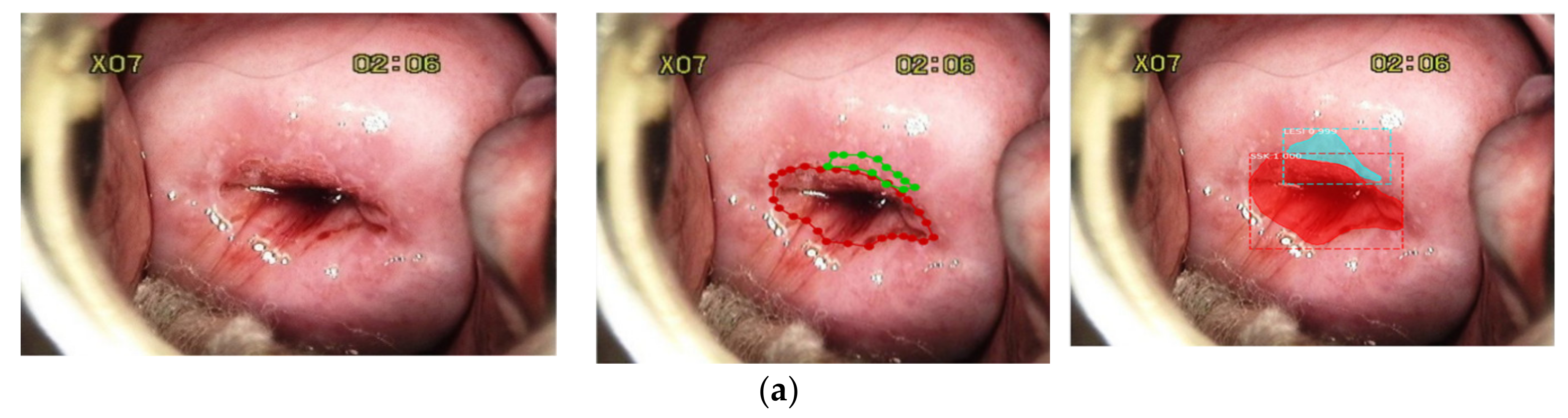 Sensors 22 05489 g009a