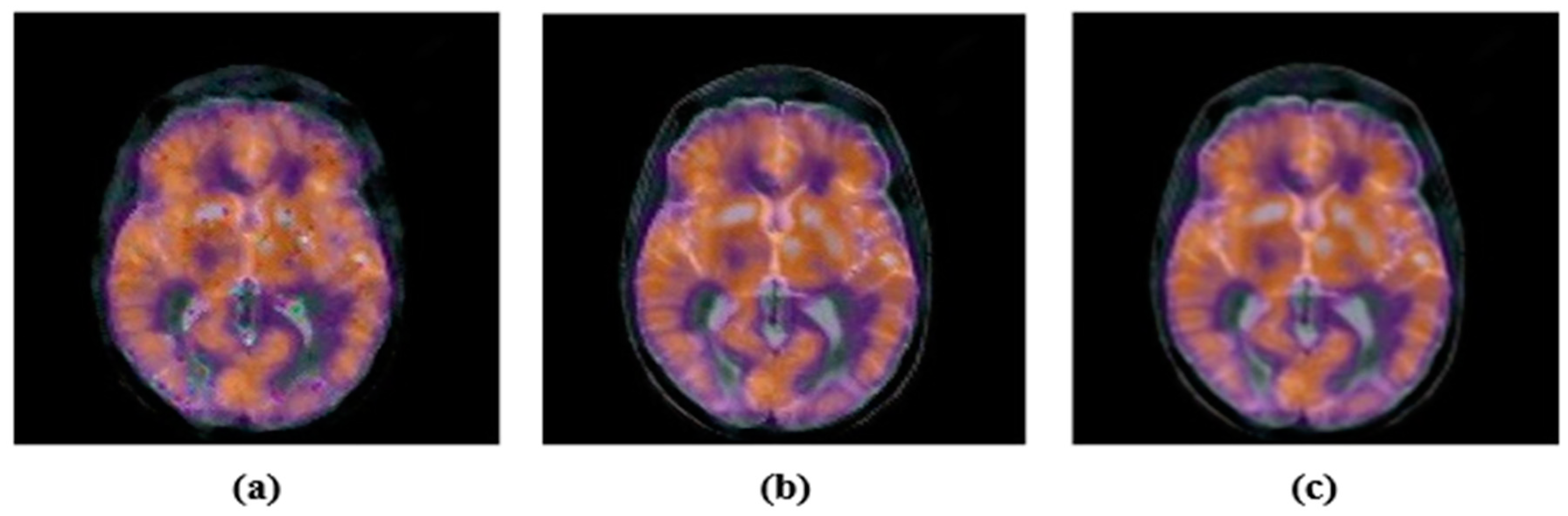 Sensors 22 05612 g007