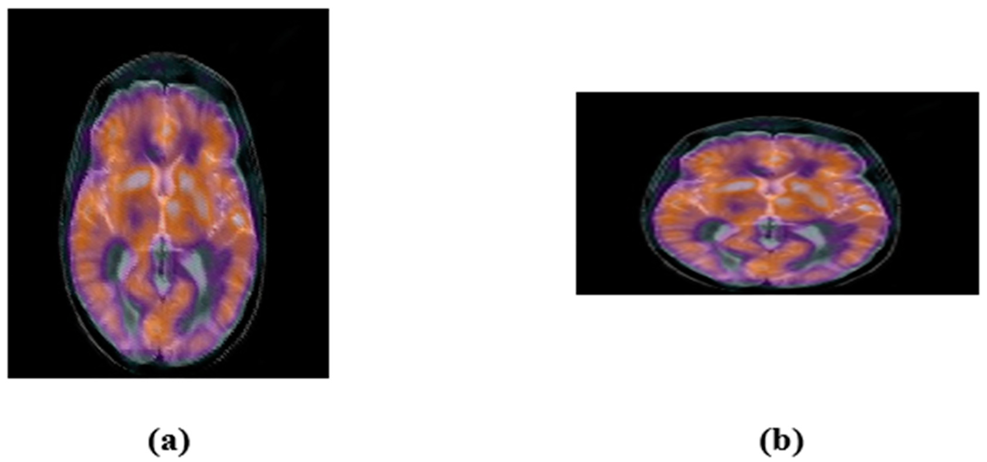 Sensors 22 05612 g010