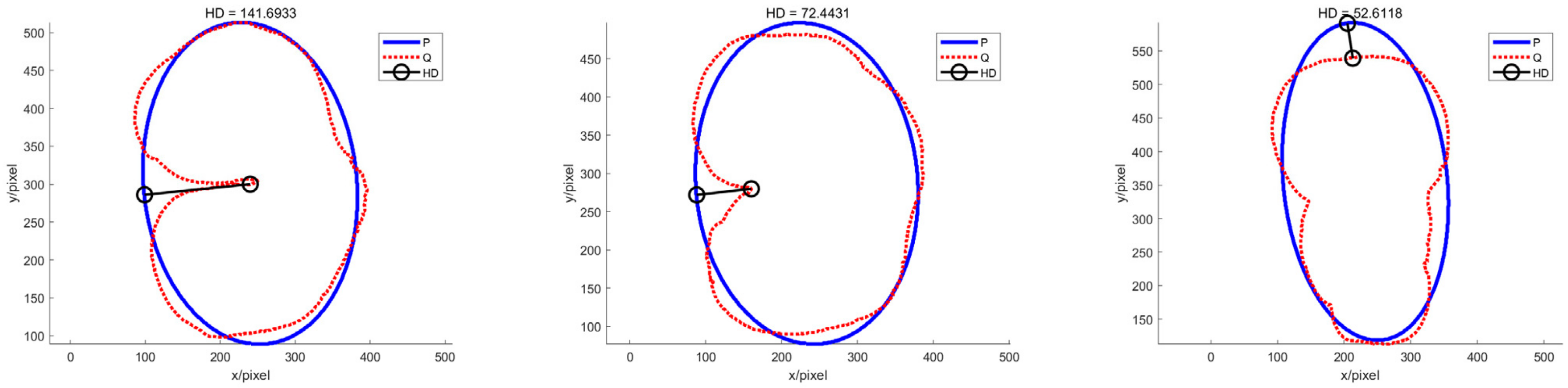 Sensors 22 05740 g015 550