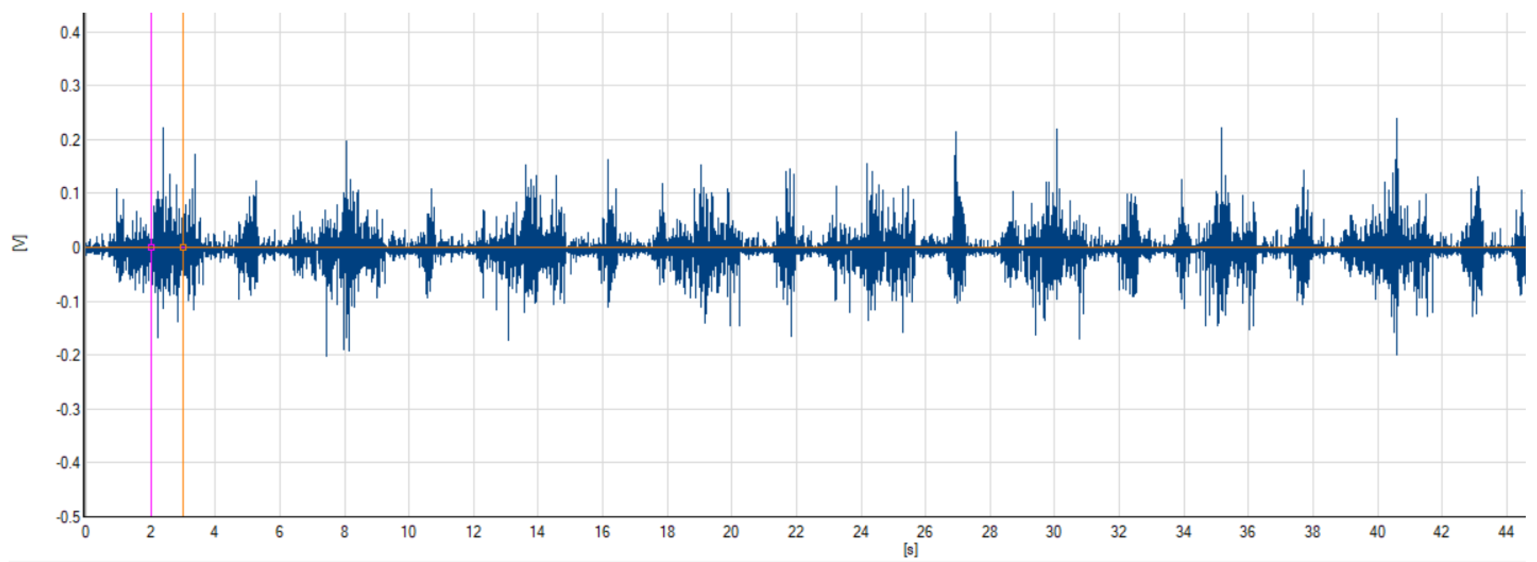 Sensors Free FullText Design Validation of a LowCost EMG Sensor