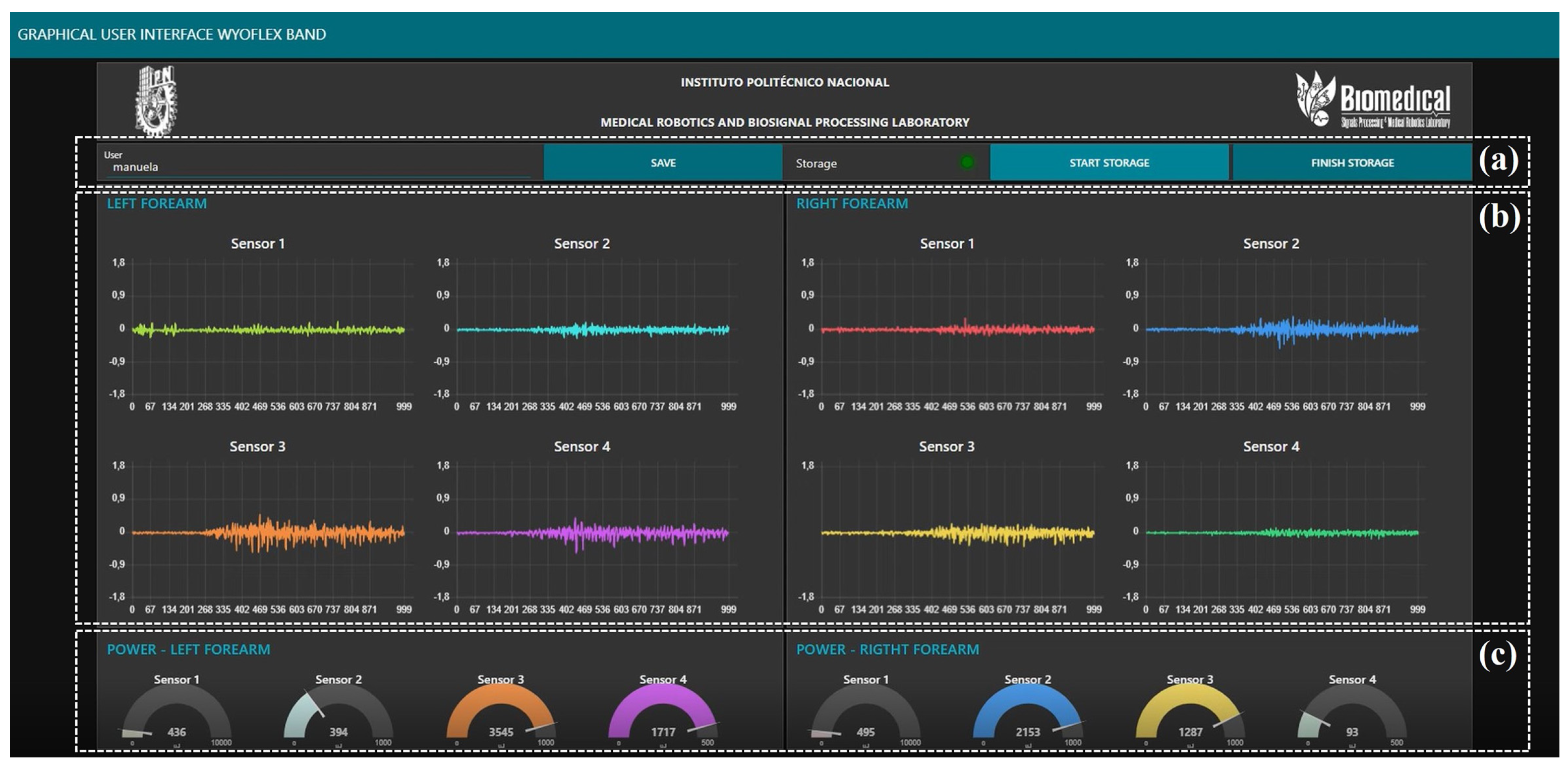 Sensors Free FullText LowCost Wearable Band Sensors of Surface