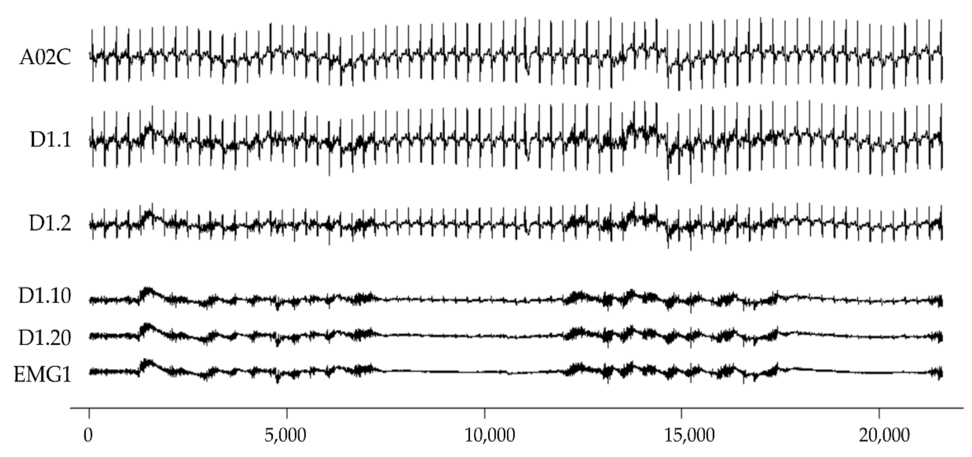 Sensors 22 05948 g001
