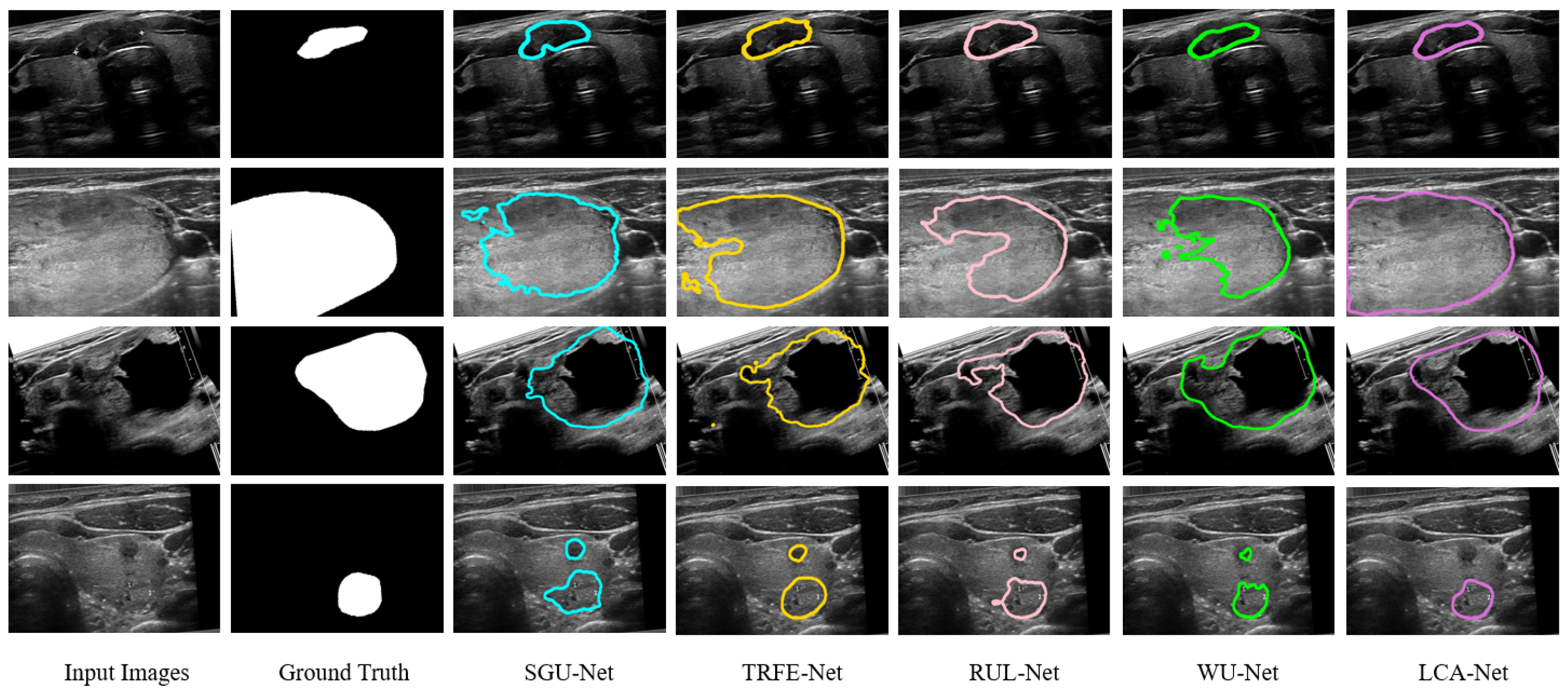 Sensors 22 05984 g007 550