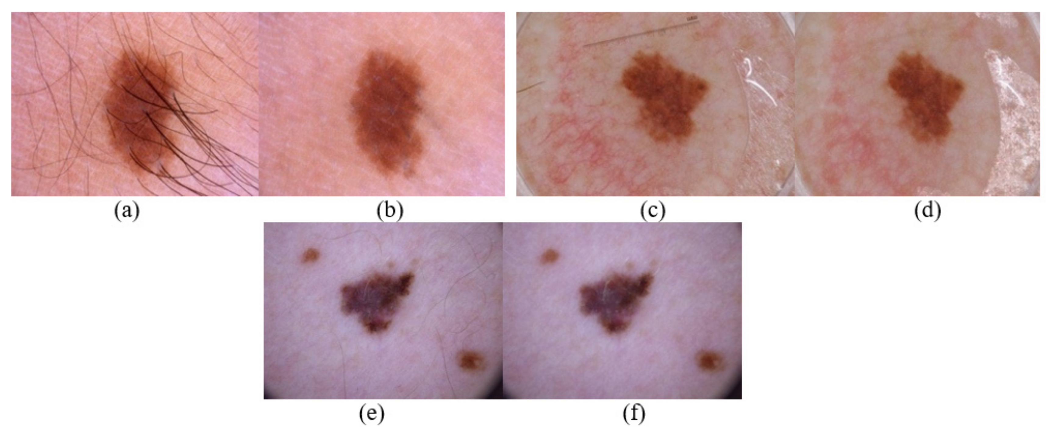 Sensors 22 06261 g007 550