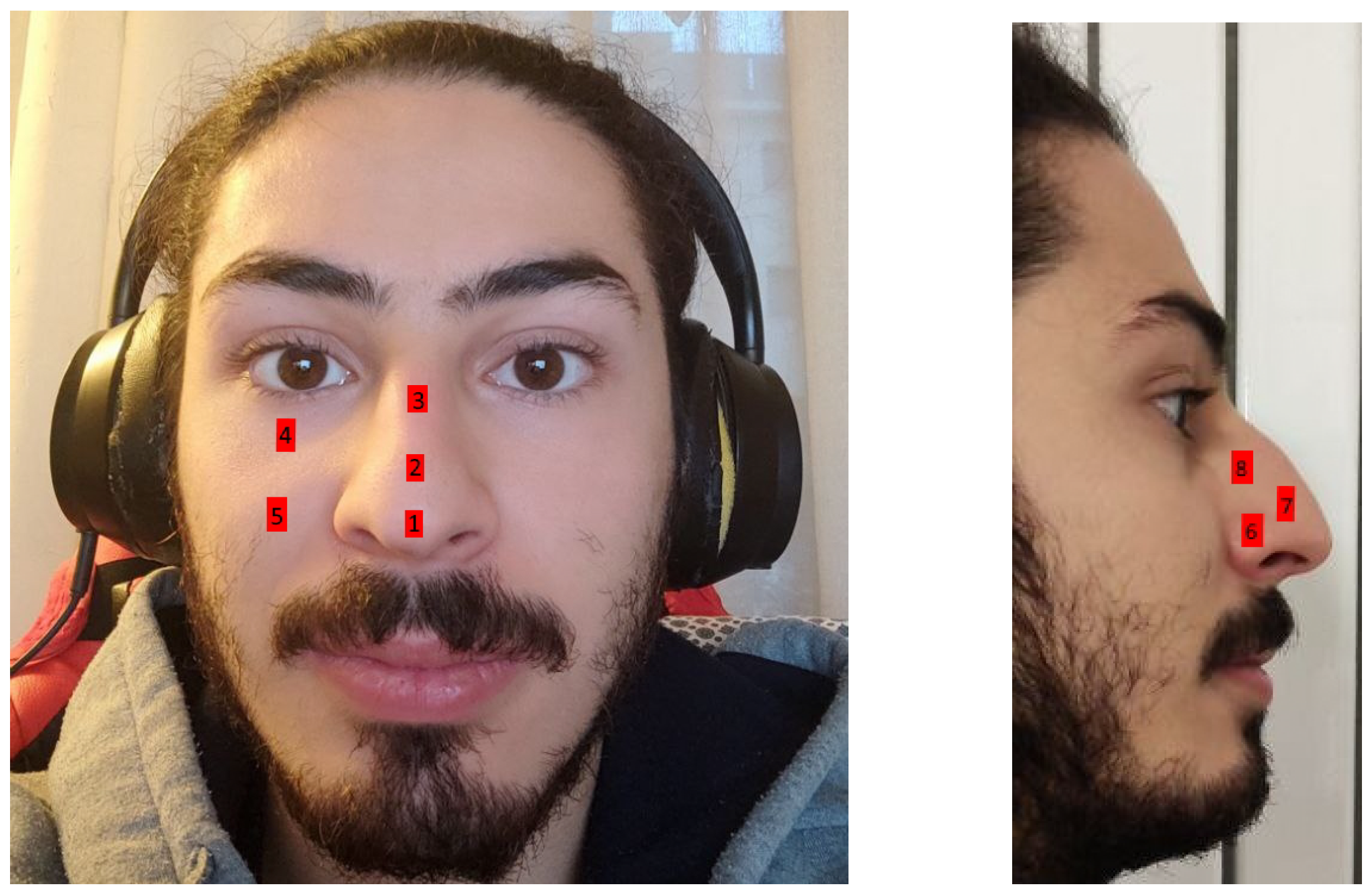 Sensors 22 06365 g007 550