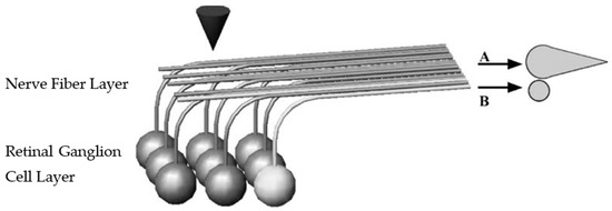 Wireless floating microelectrode array (WFMA) device before