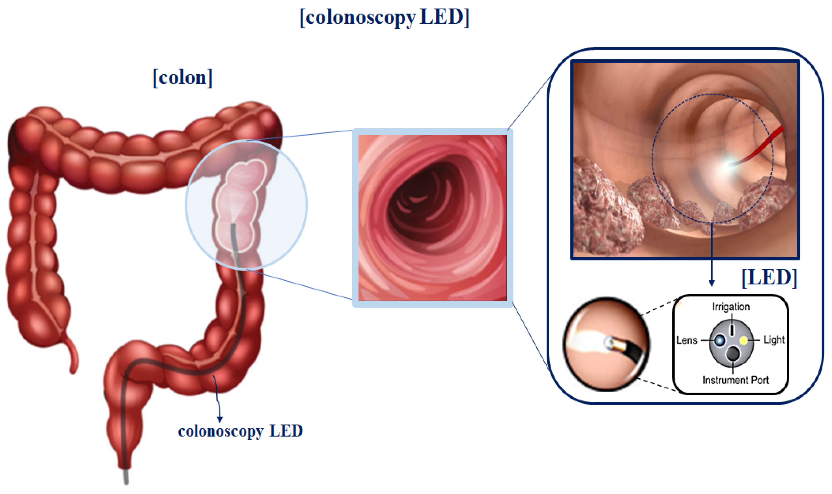 Sensors 22 06651 g002