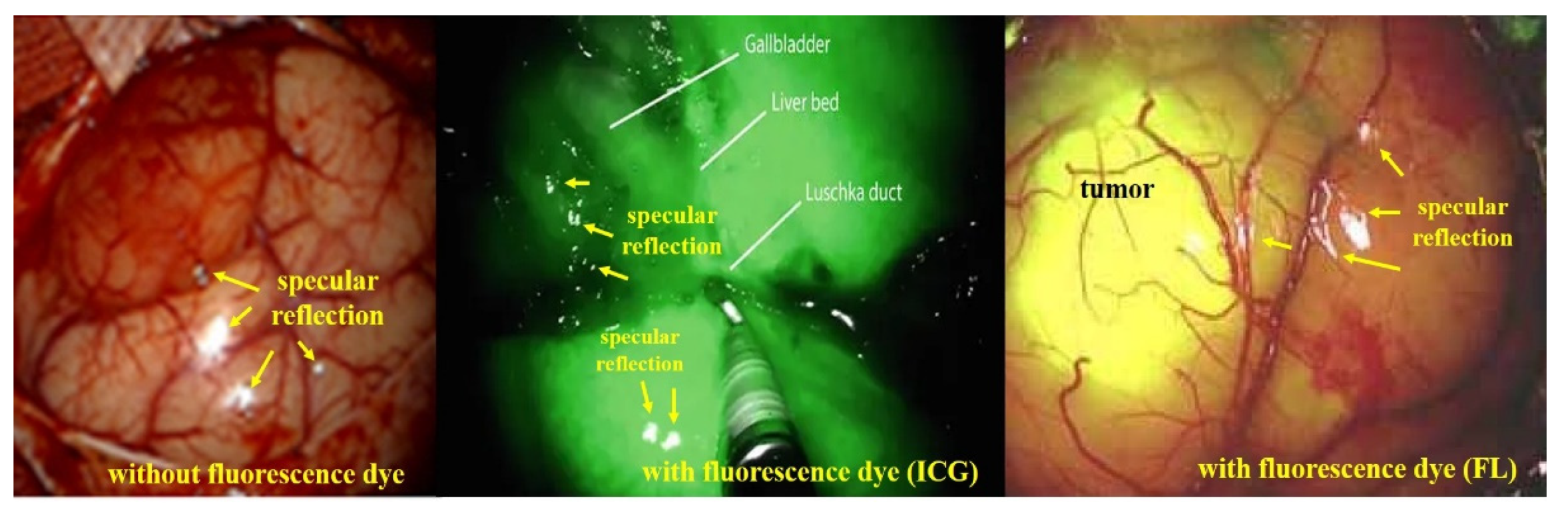 Sensors 22 06651 g006