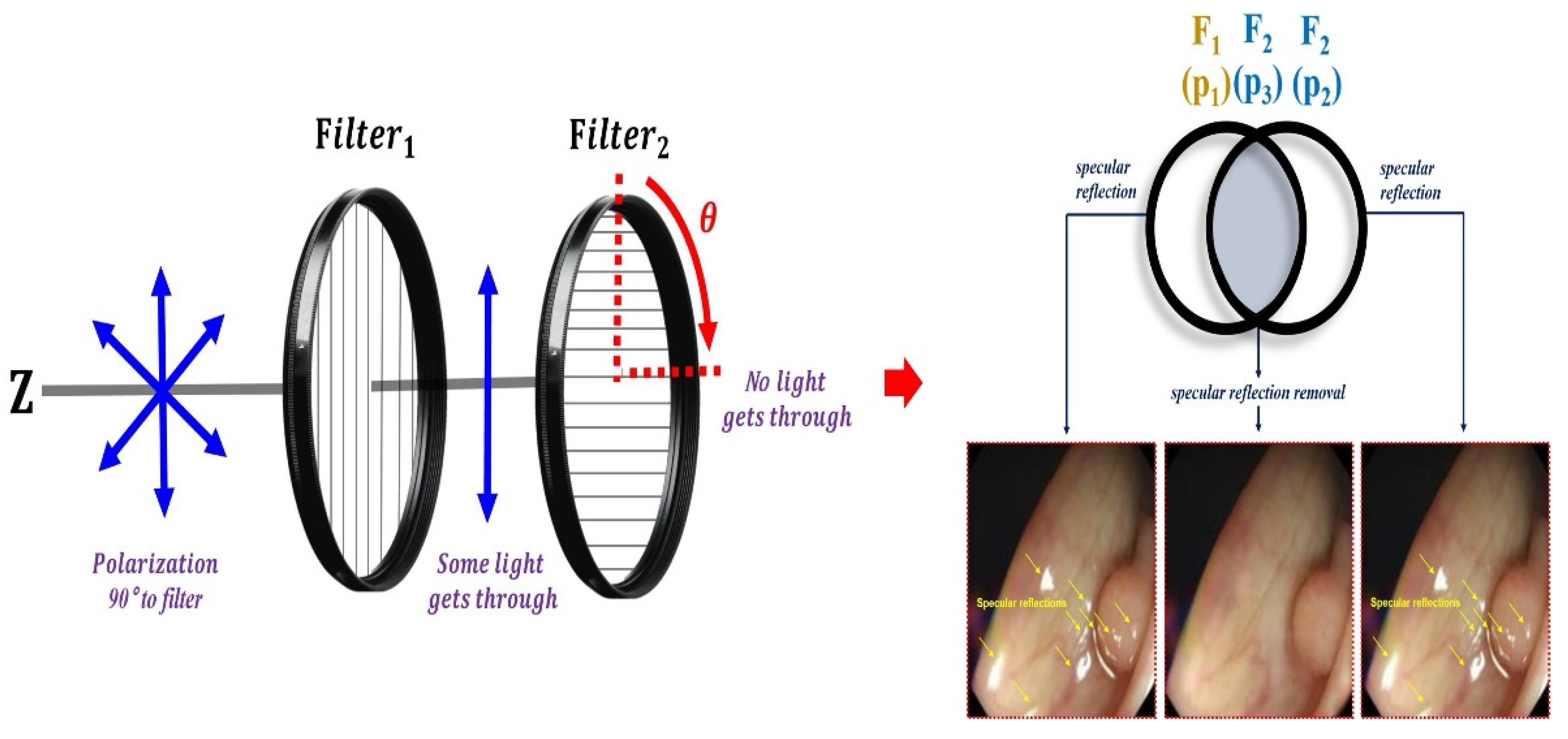 Specular Reflection Suppression through the Adjustment of Linear