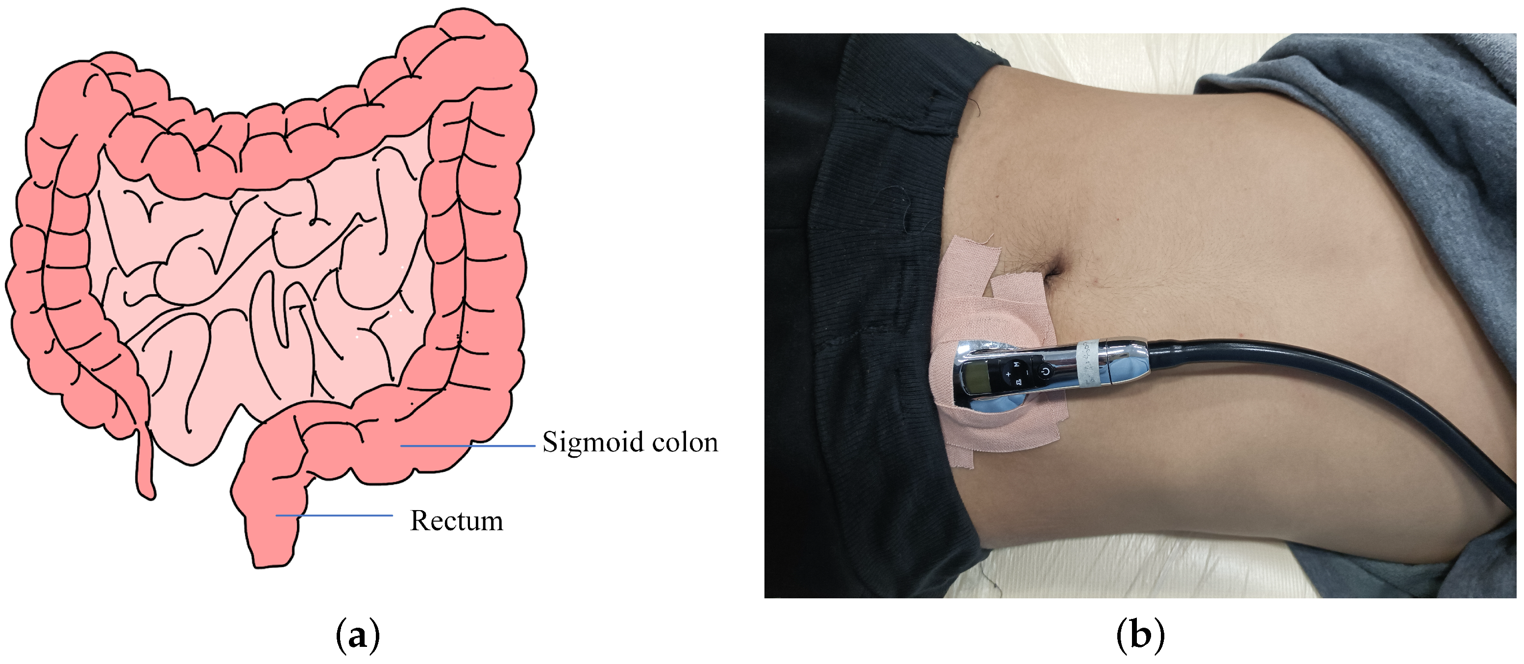 Sensors 22 06704 g005