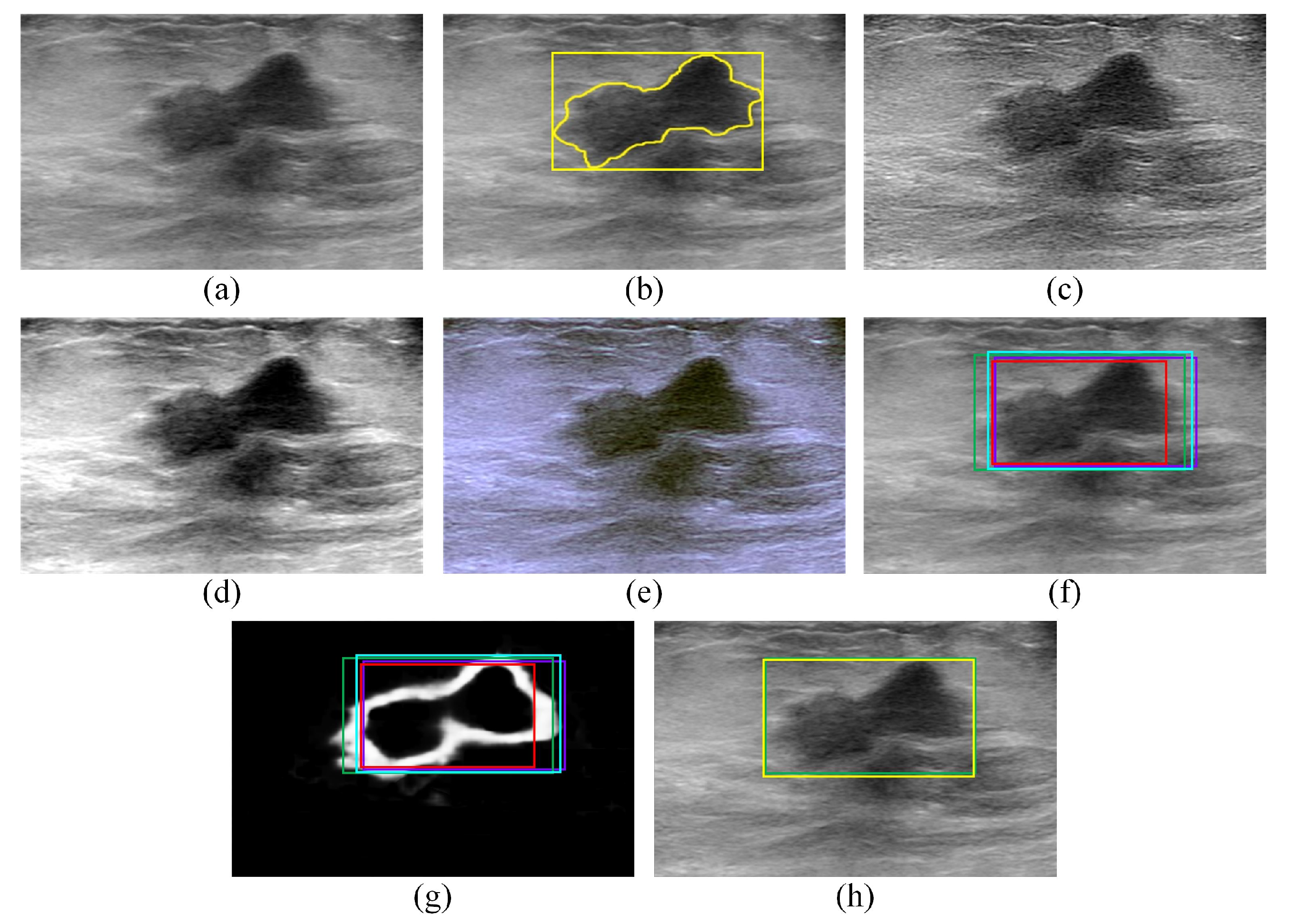 Sensors 22 06721 g004 550