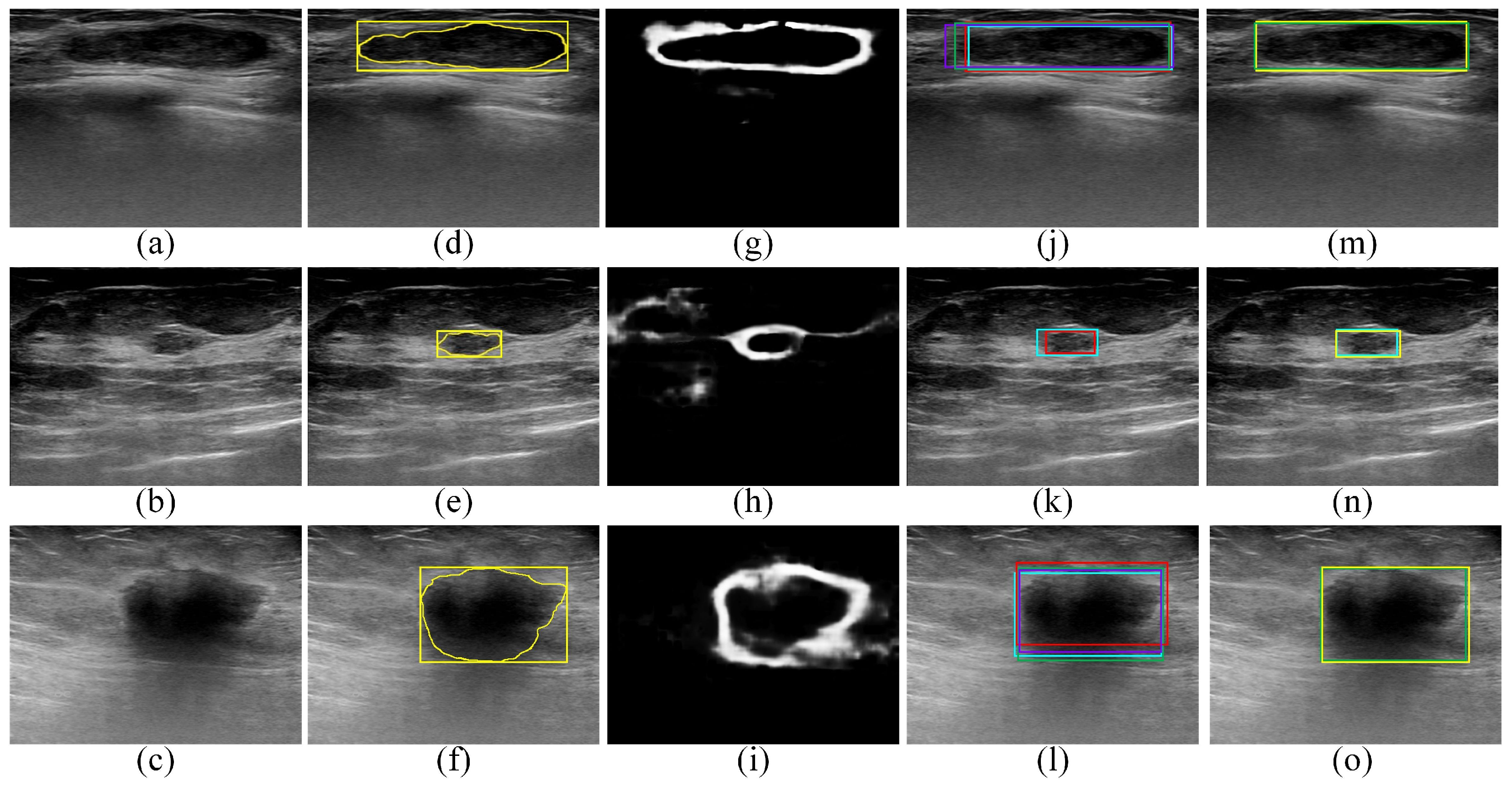 Sensors 22 06721 g005 550