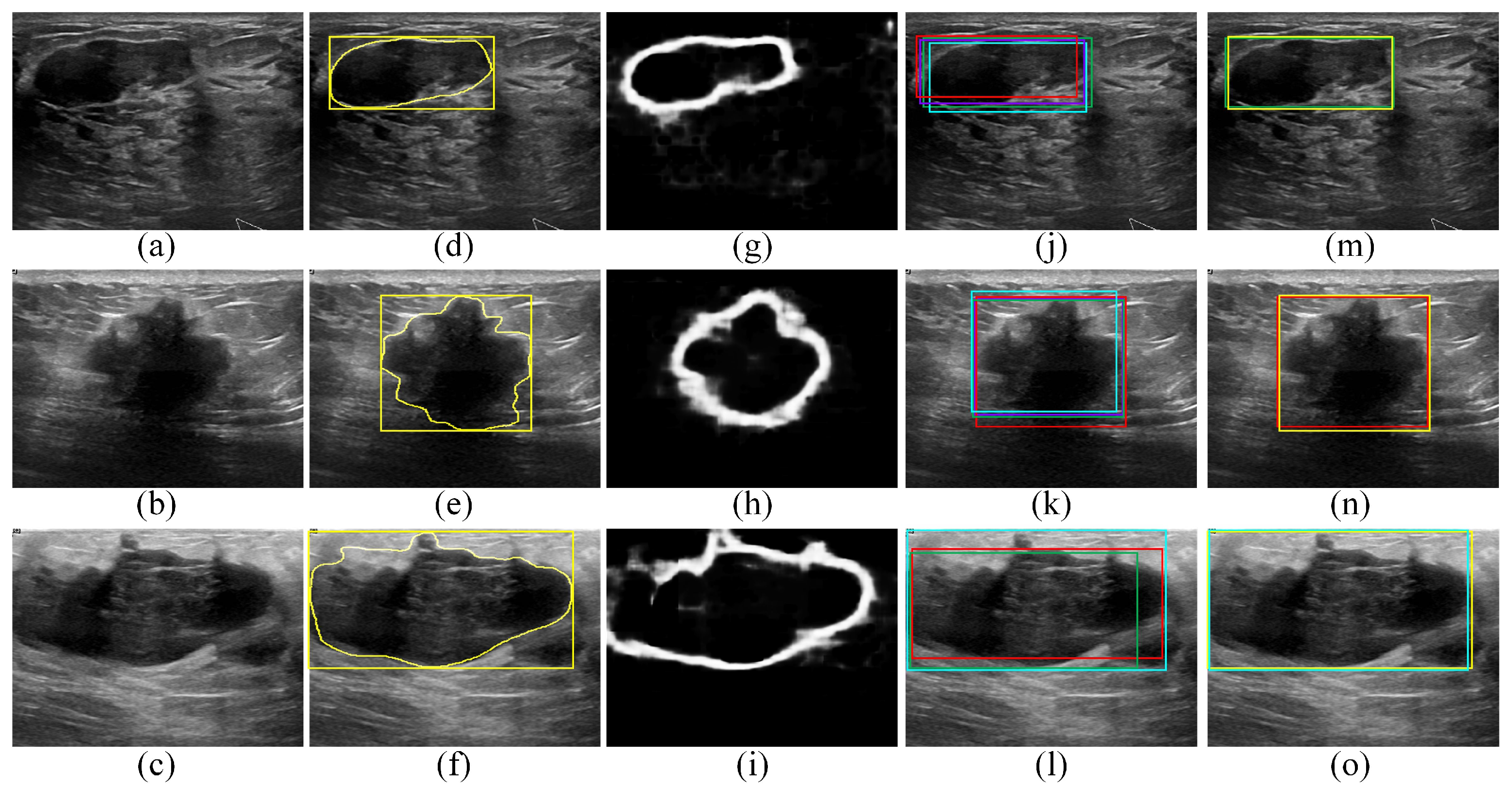 Sensors 22 06721 g006 550