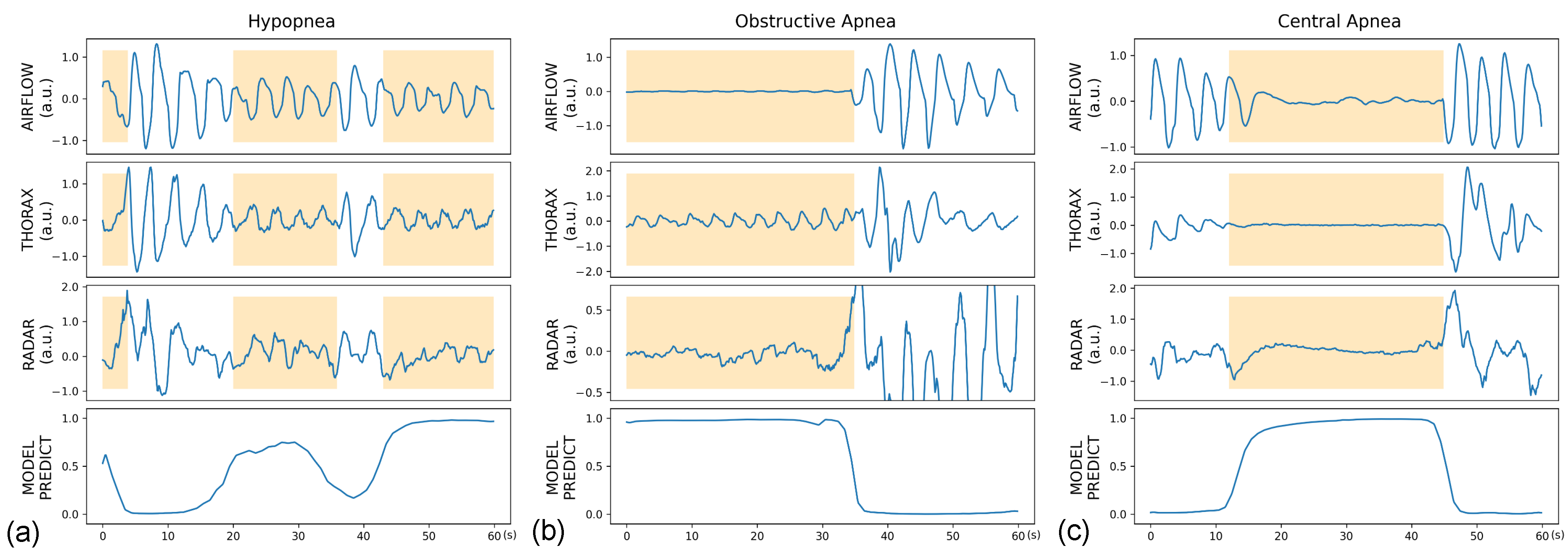 Sensors Free FullText Automated Detection of Sleep ApneaHypopnea