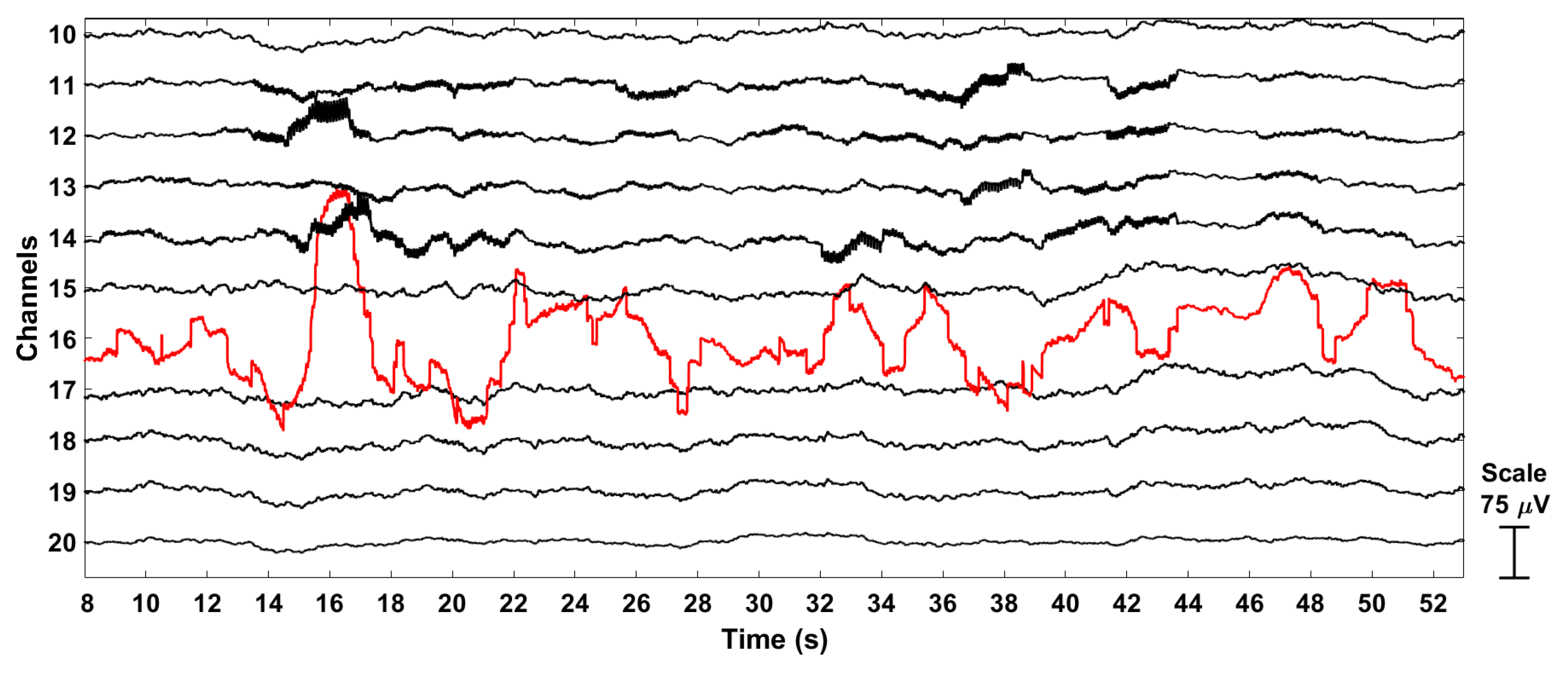 Conceptual image of bad-channel removal.