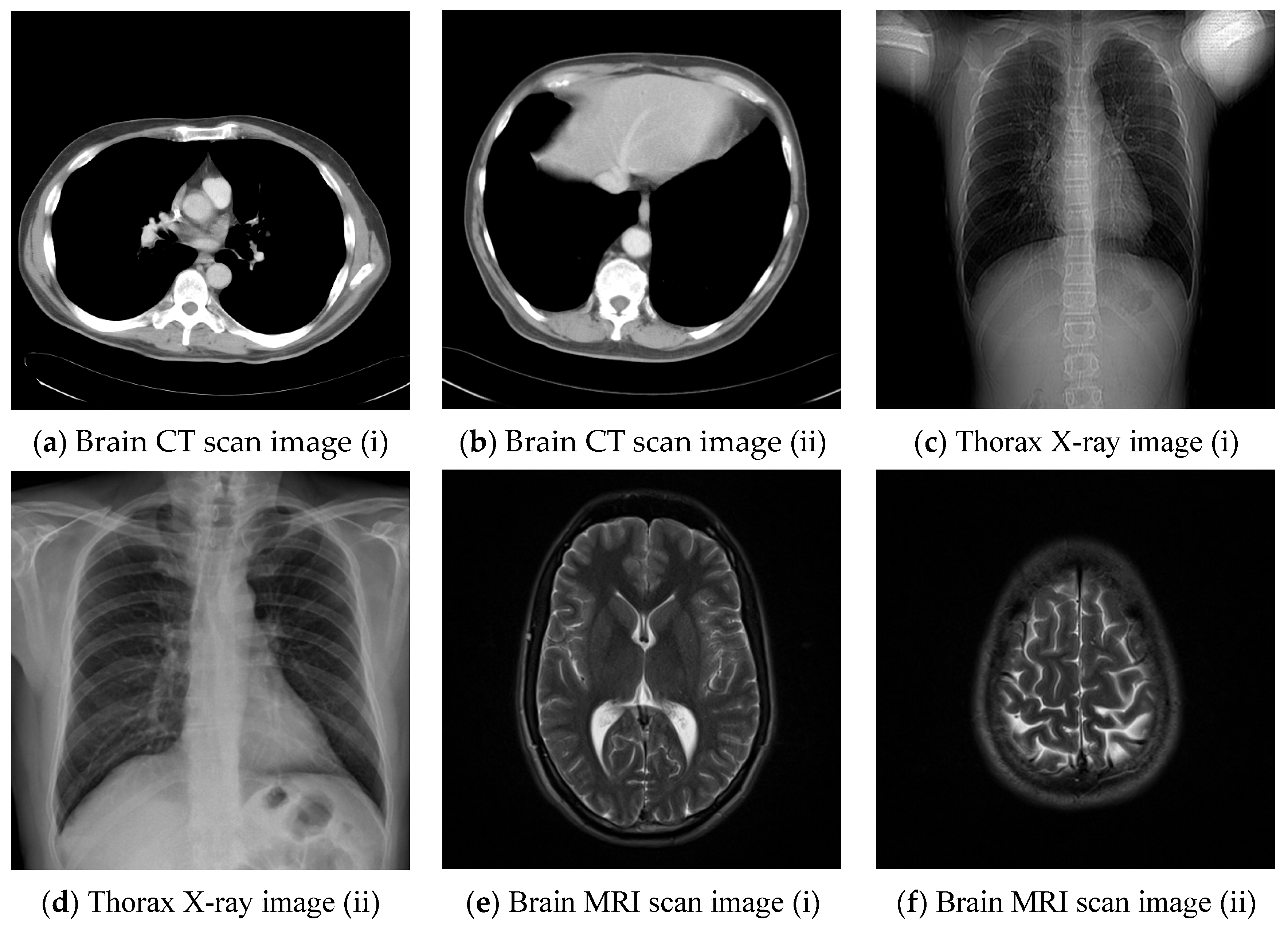 Sensors 22 07942 g010