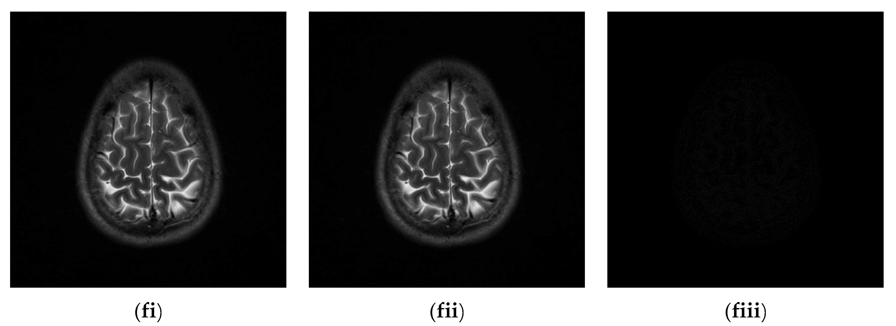 Sensors 22 07942 g011c