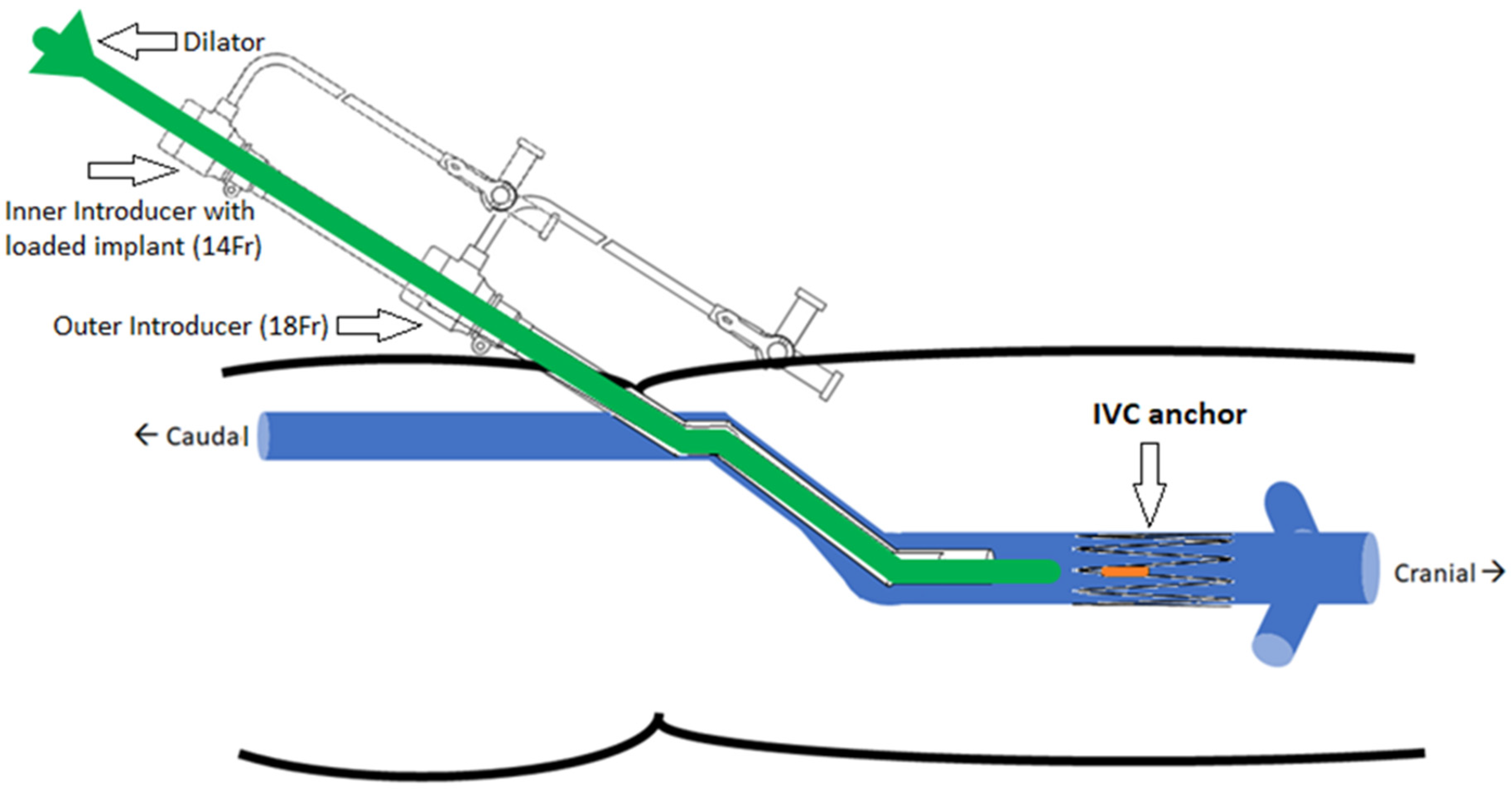 Sensors 22 08552 g005 Sensors 22 08552 g005