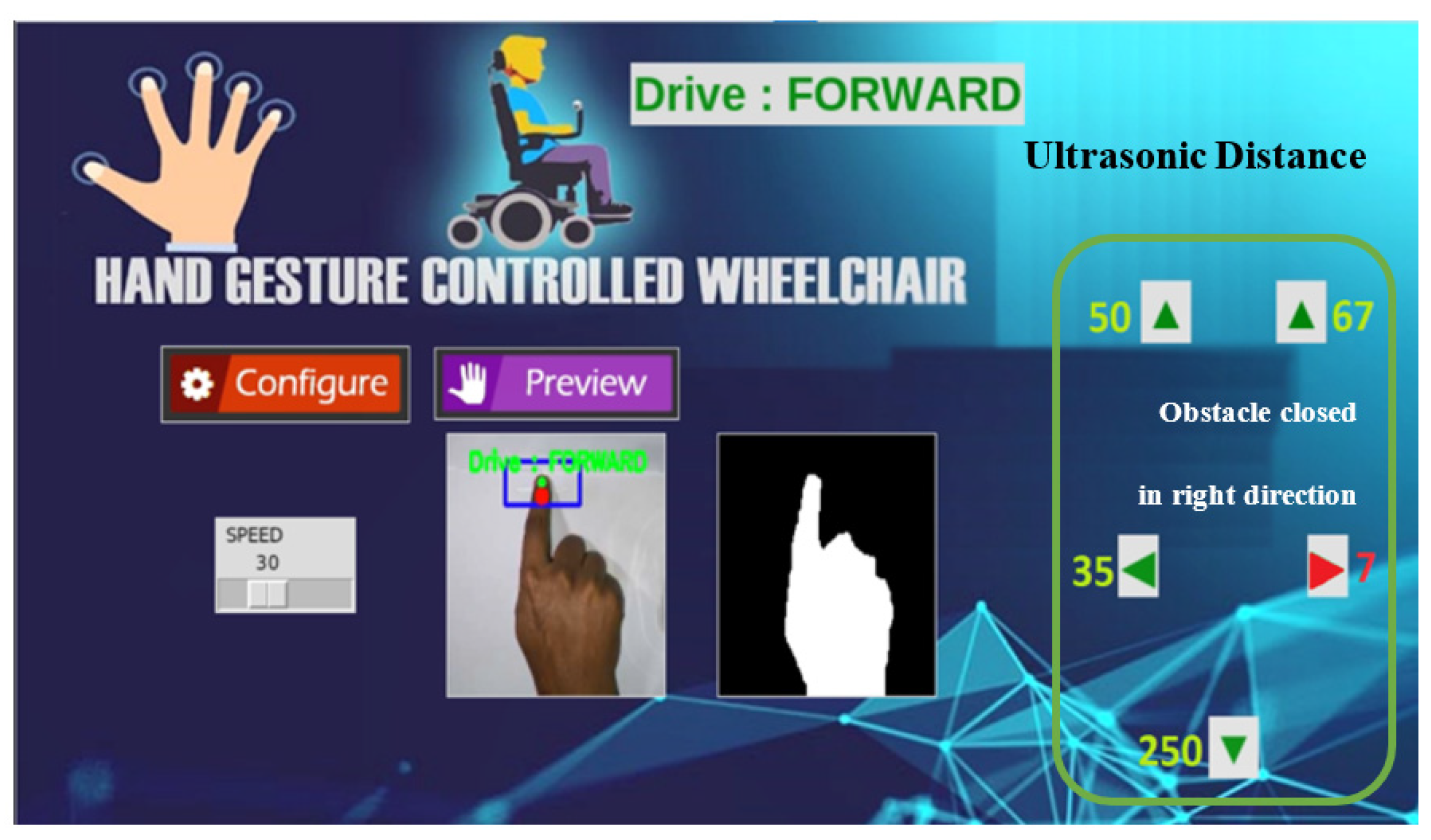 Sensors | Free Full-Text | Finger-Gesture Controlled Wheelchair with ...