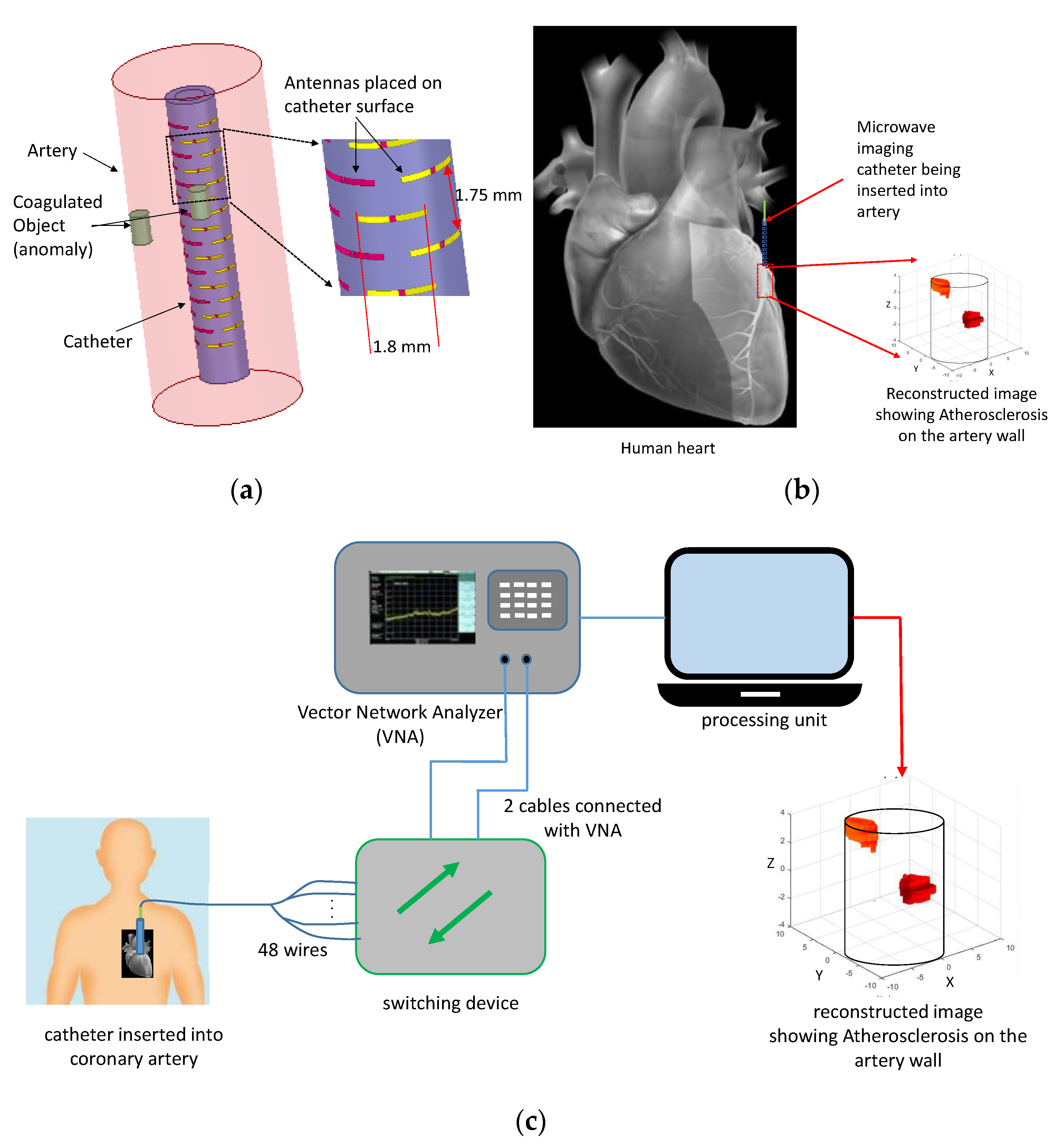 Real-Time Detection and 3D Localization of Coronary