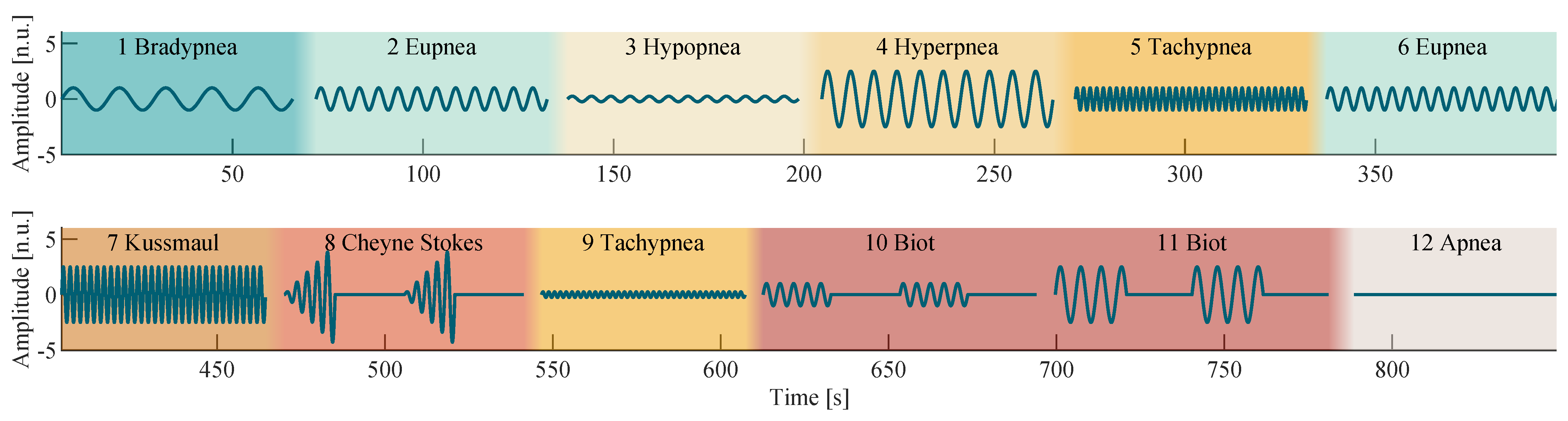 Sensors Free FullText Breathing Pattern Monitoring by Using Remote