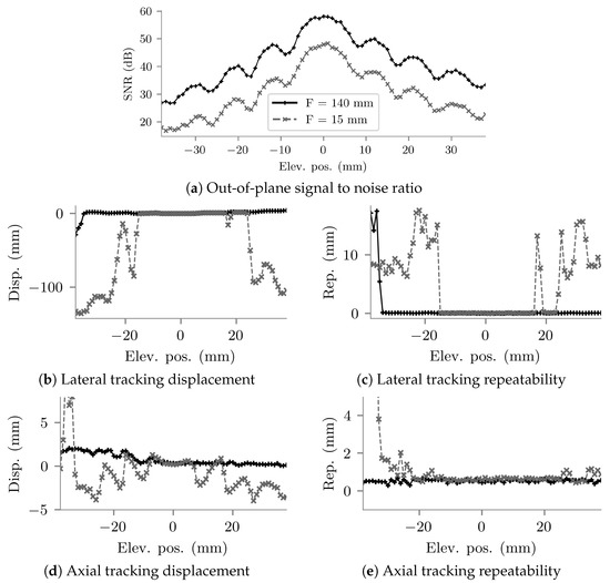 Sensors Free FullText Intraoperative Needle Tip Tracking with an