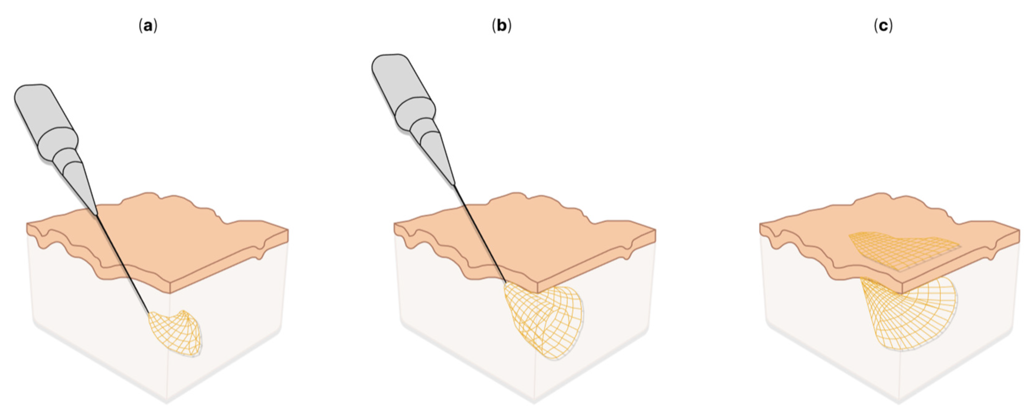 Sensors 22 09085 g005 Sensors 22 09085 g005