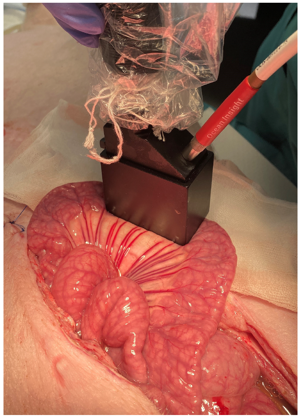 Sensors 22 09111 g001