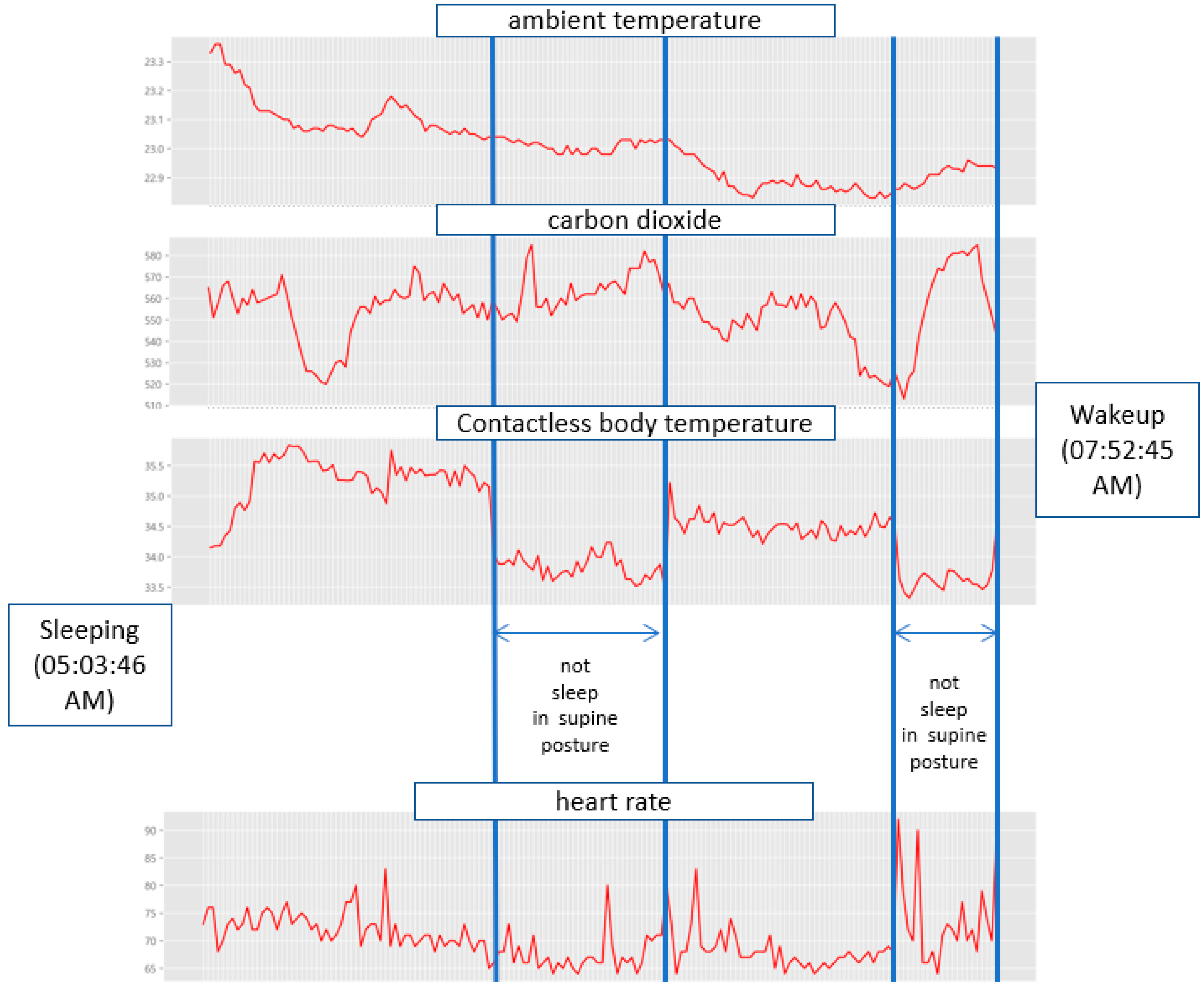 Sensors Free FullText Sleep Pattern Analysis in Unconstrained and