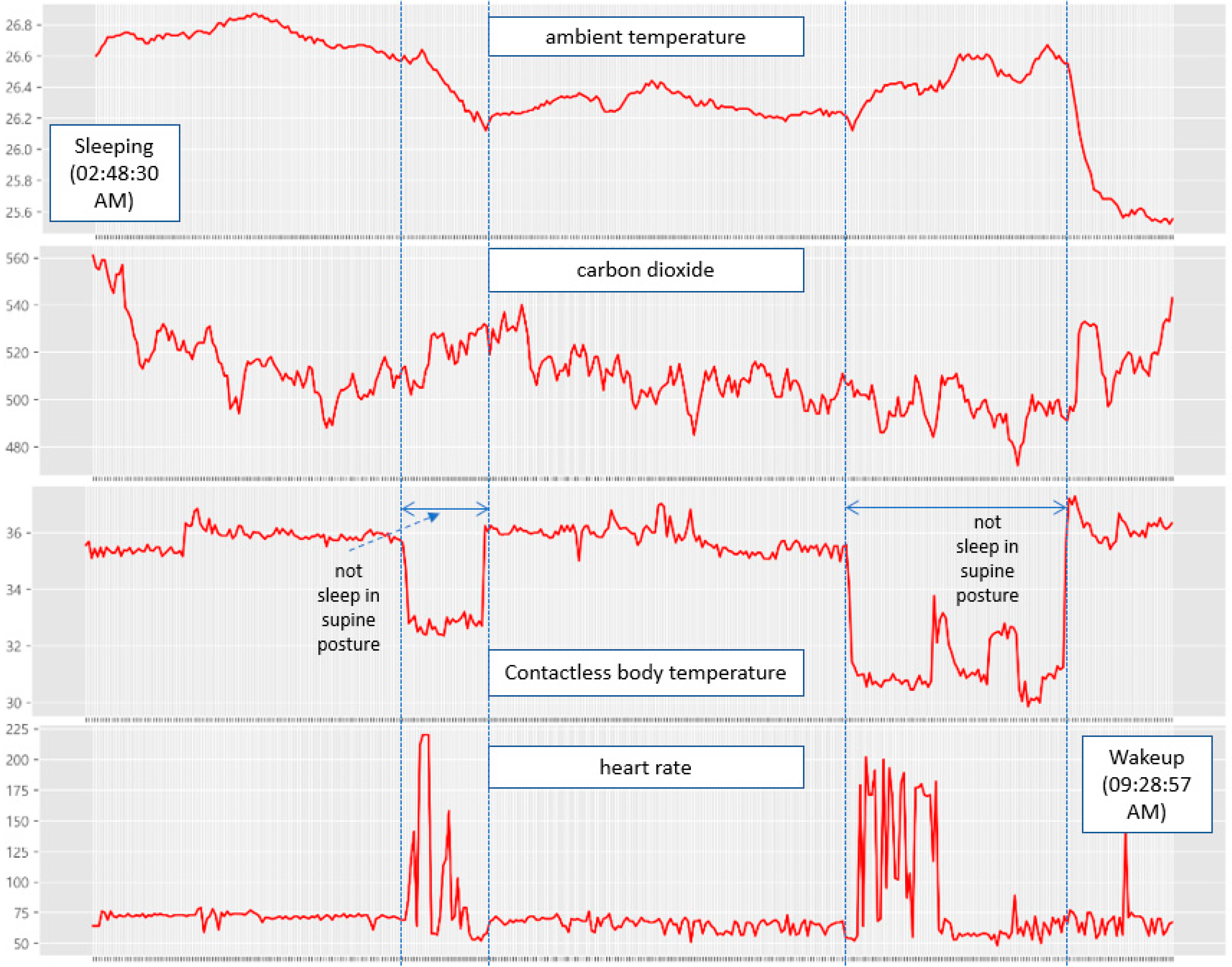 Sensors 22 09296 g025