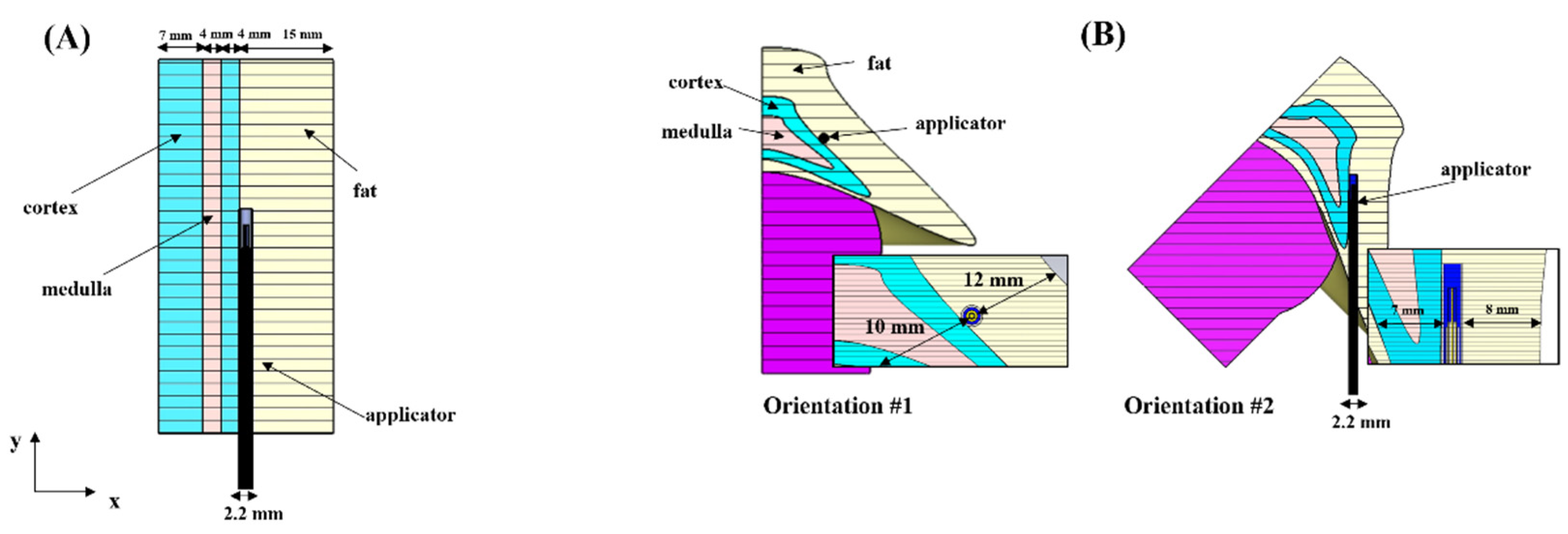 Sensors 22 09320 g001 Sensors 22 09320 g001