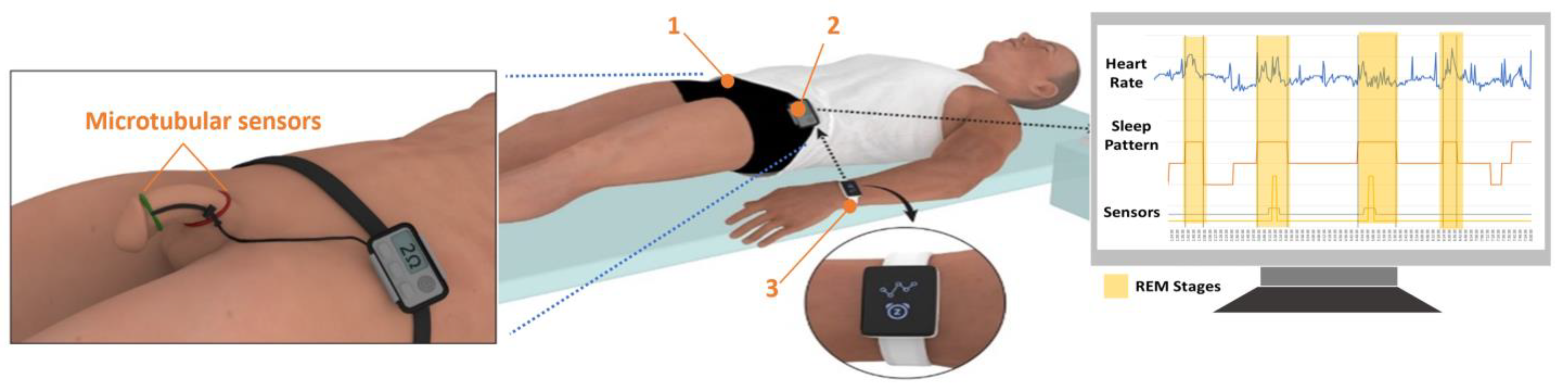 Sensors 22 09344 g001 Sensors 22 09344 g001