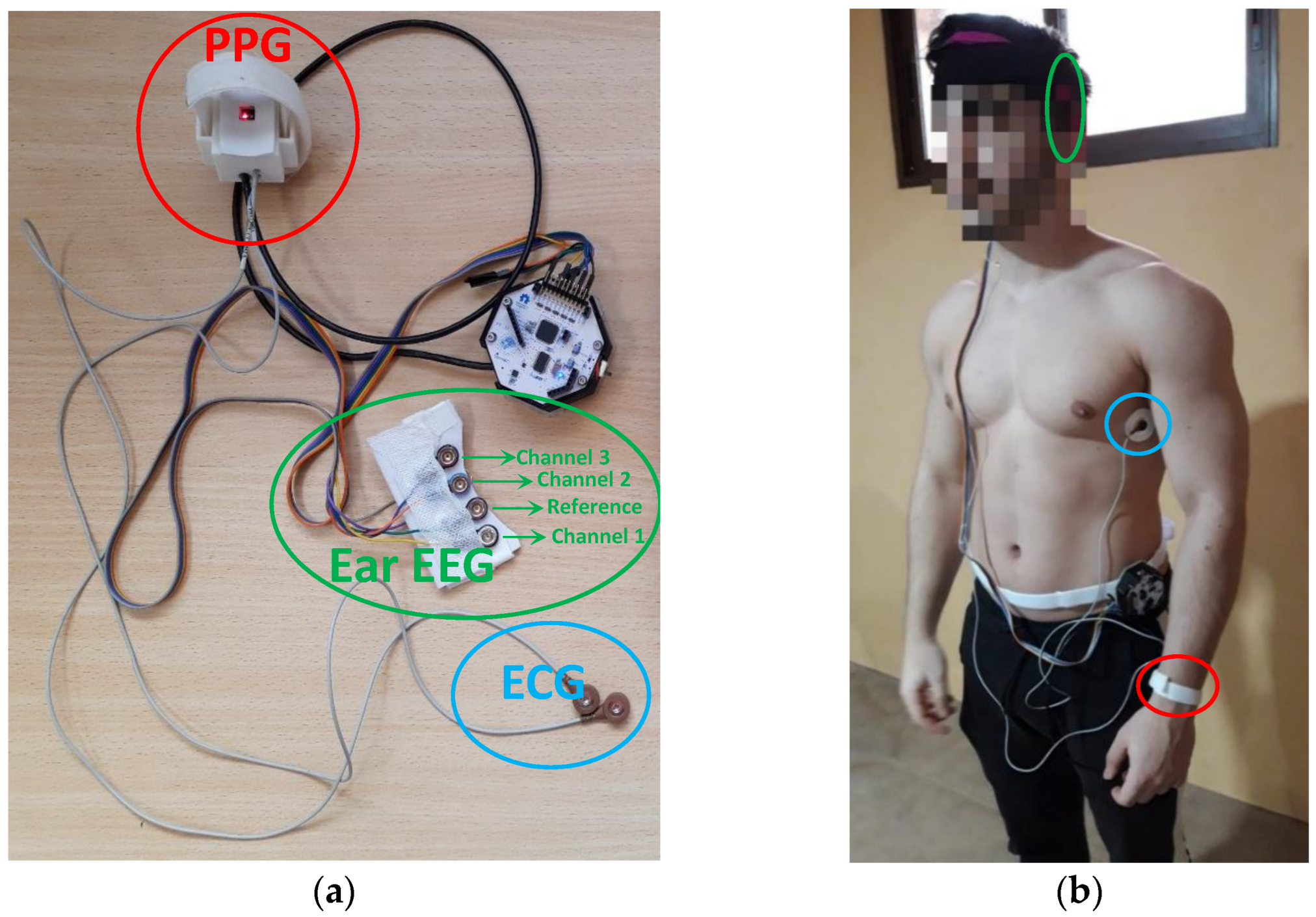 Sensors 22 09372 g002 Sensors 22 09372 g002