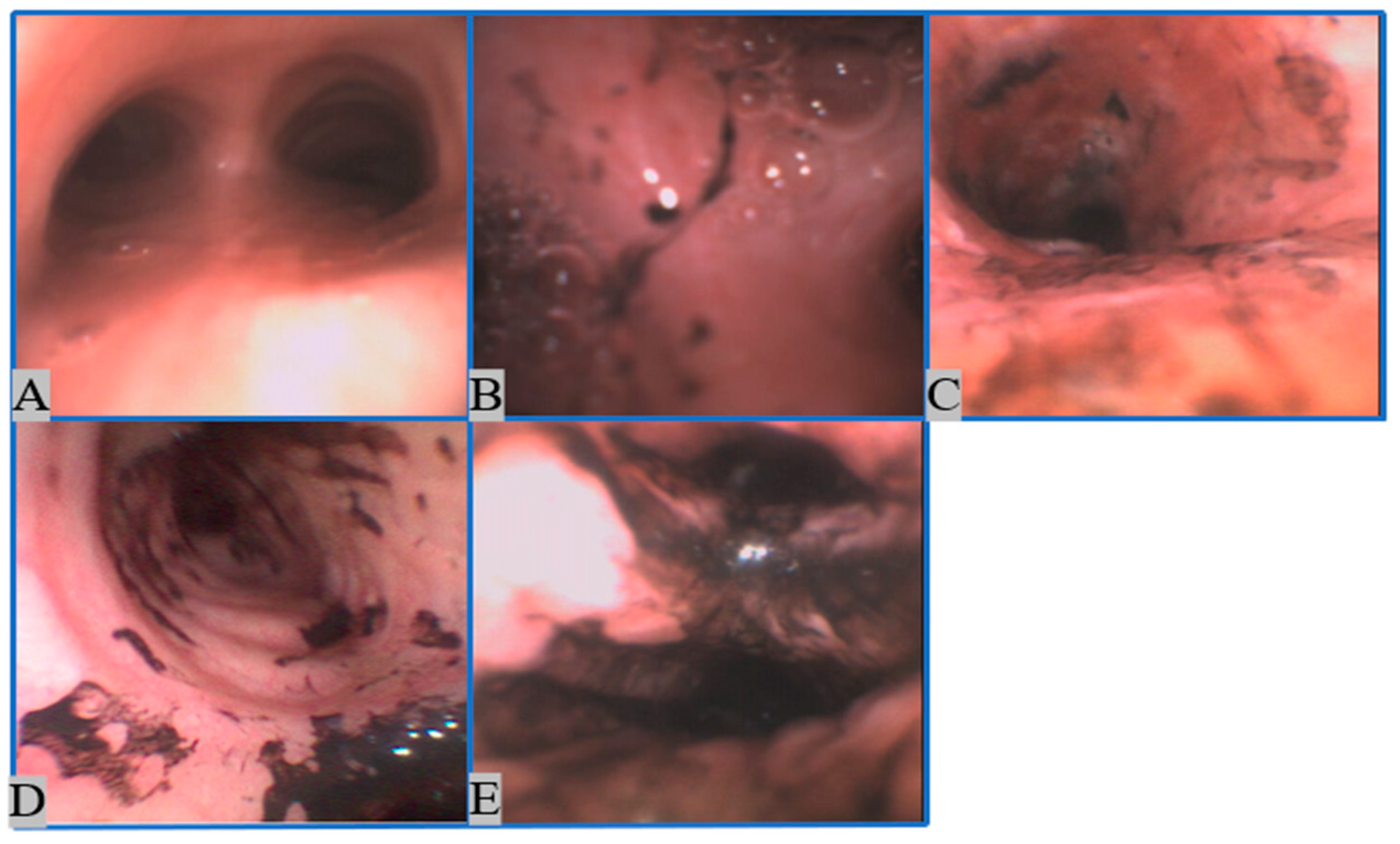 Sensors 22 09430 g001 Sensors 22 09430 g001