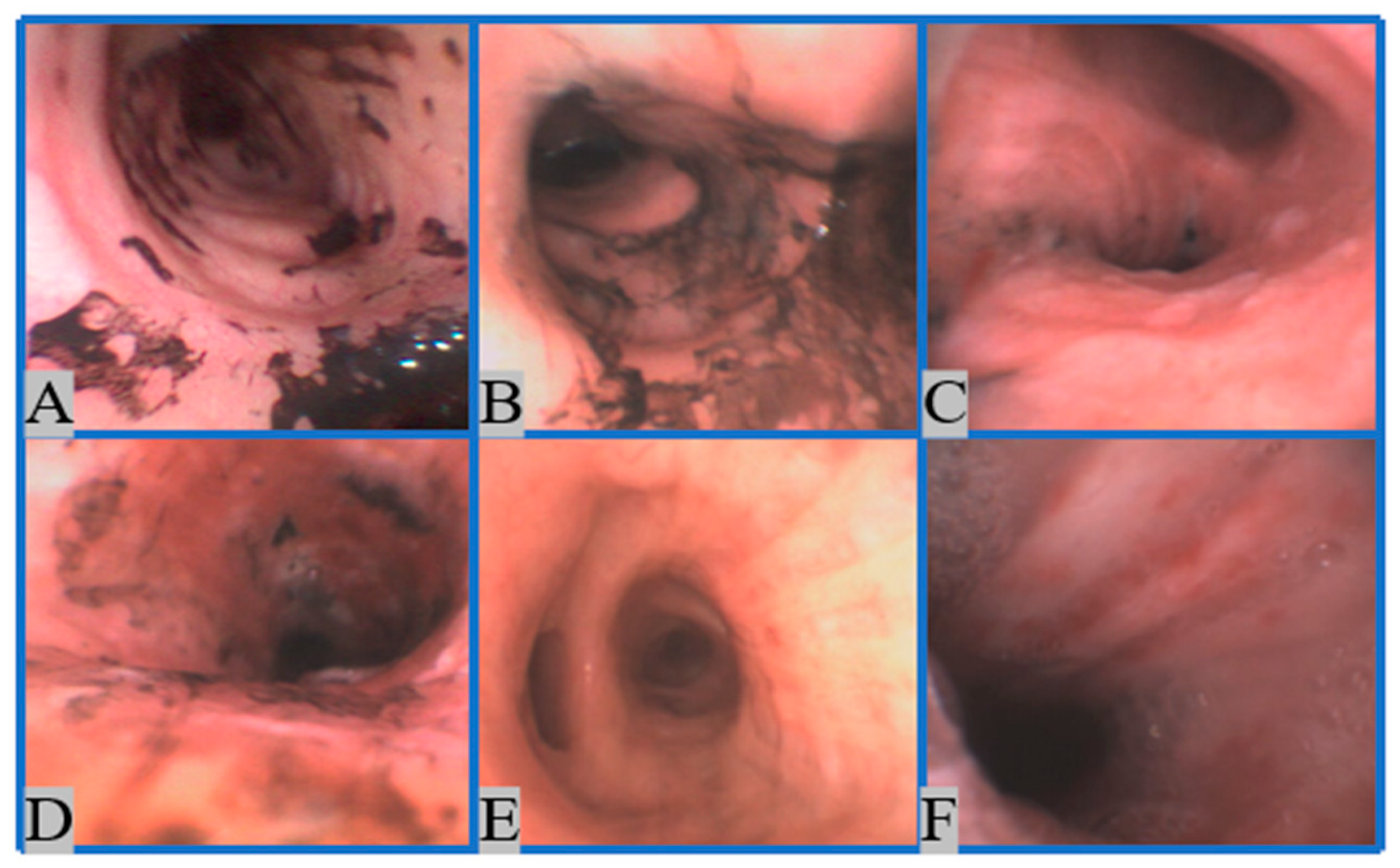 Sensors 22 09430 g003 Sensors 22 09430 g003