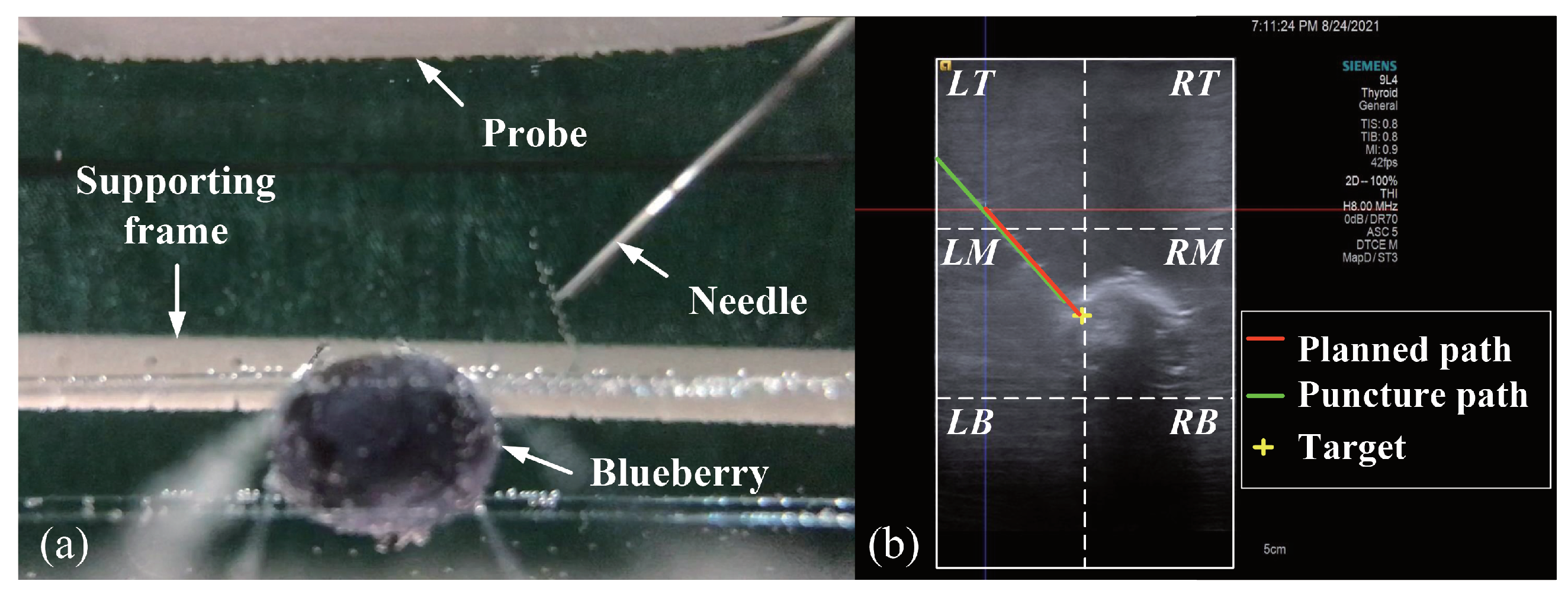 Sensors 22 09465 g010