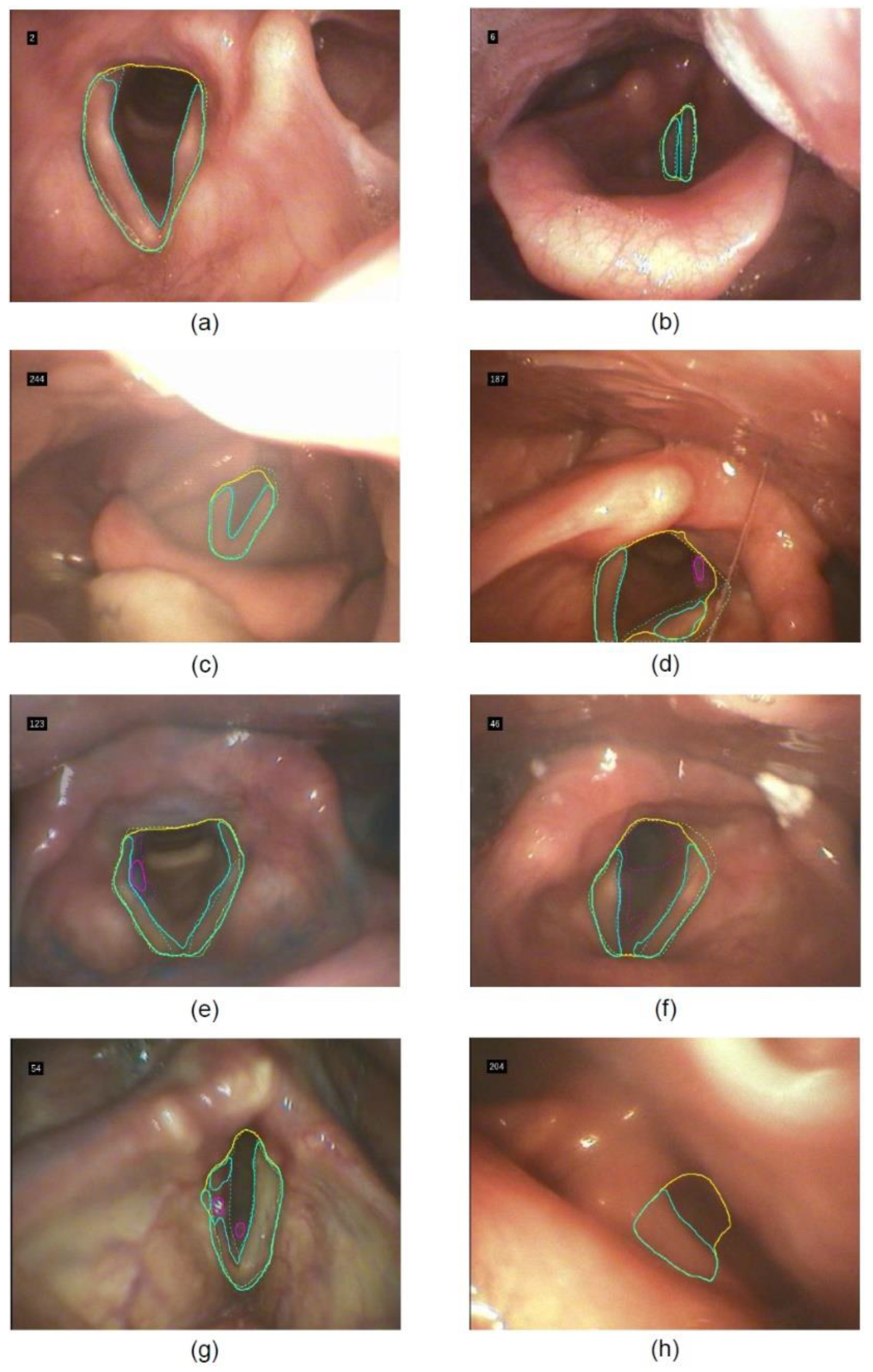 Sensors 22 09468 g005 Sensors 22 09468 g005