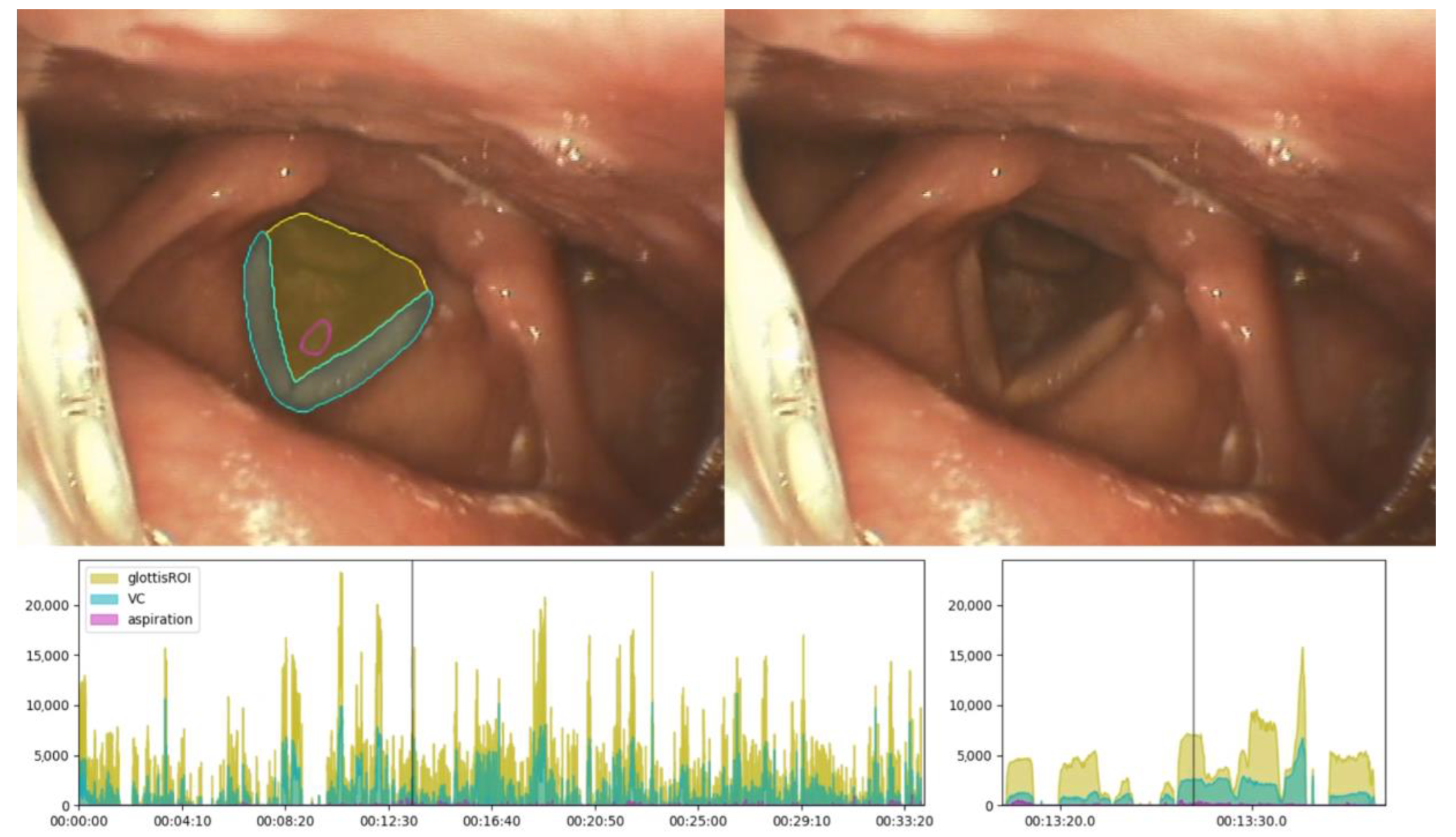 Sensors 22 09468 g007 Sensors 22 09468 g007